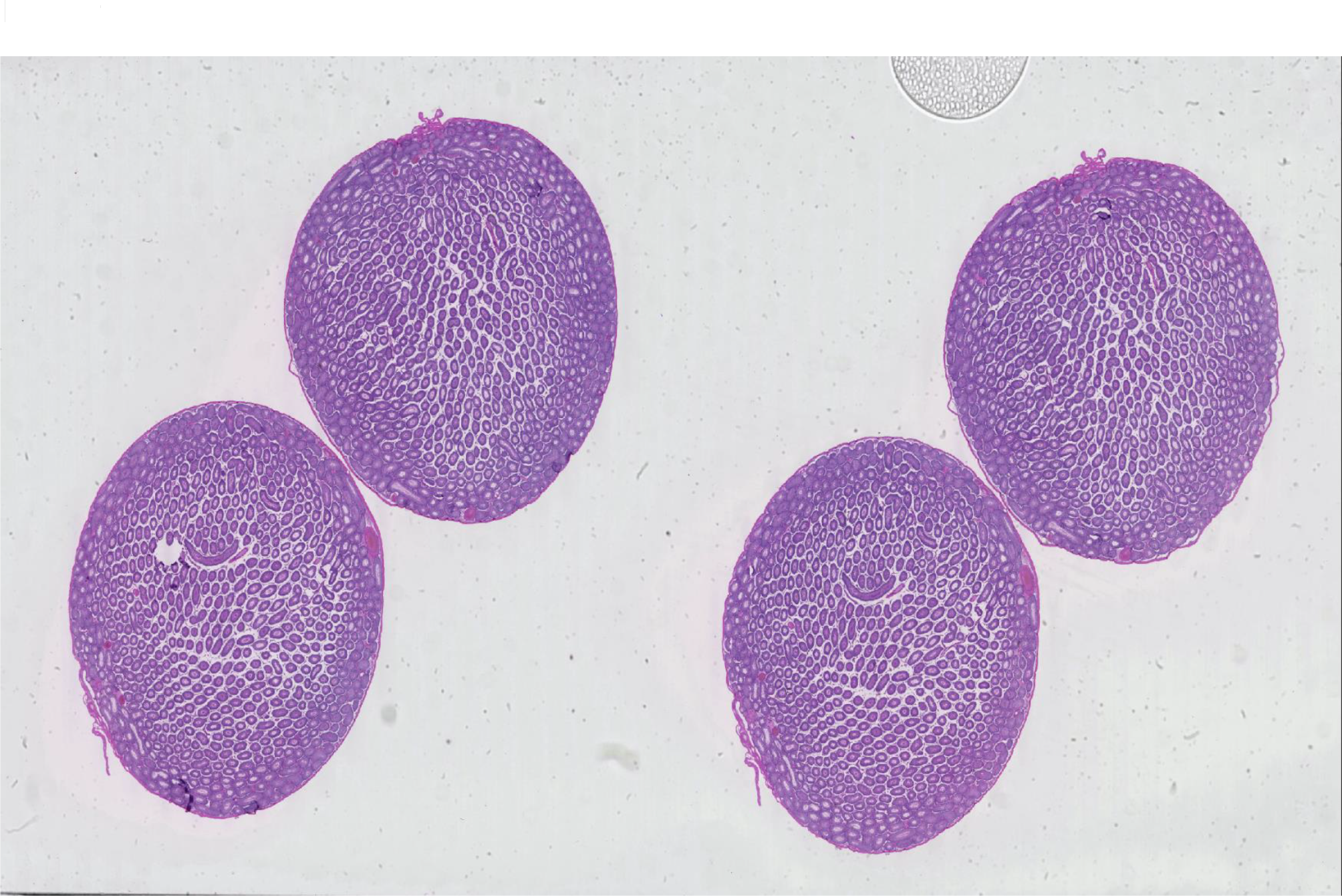 AIが人間より早く、優れた方法で潜在的な病気を発見(AI method can spot potential disease faster, better than humans)