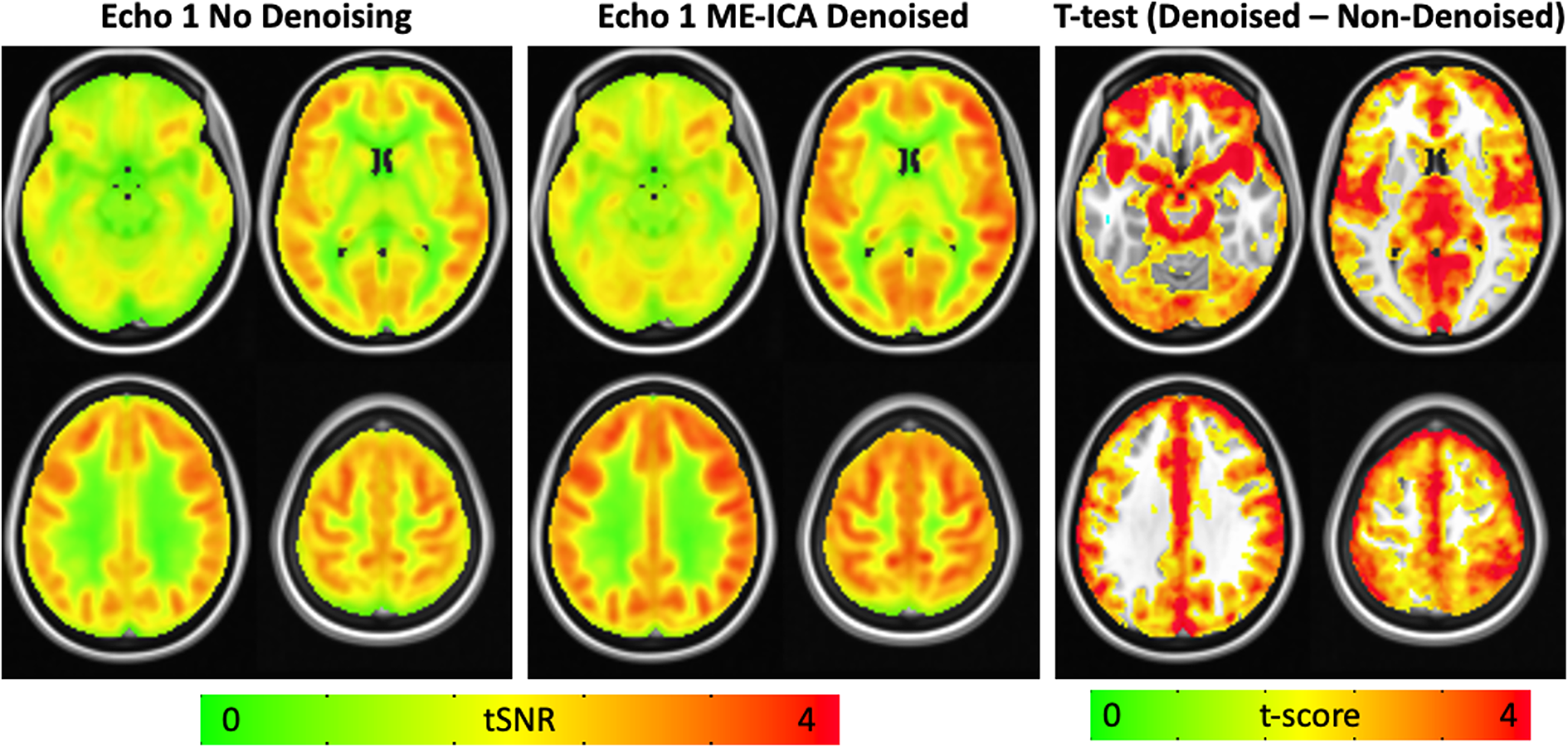 Resting state BOLD-perfusion coupling patterns using multiband multi-echo  pseudo-continuous arterial spin label imaging | Scientific Reports
