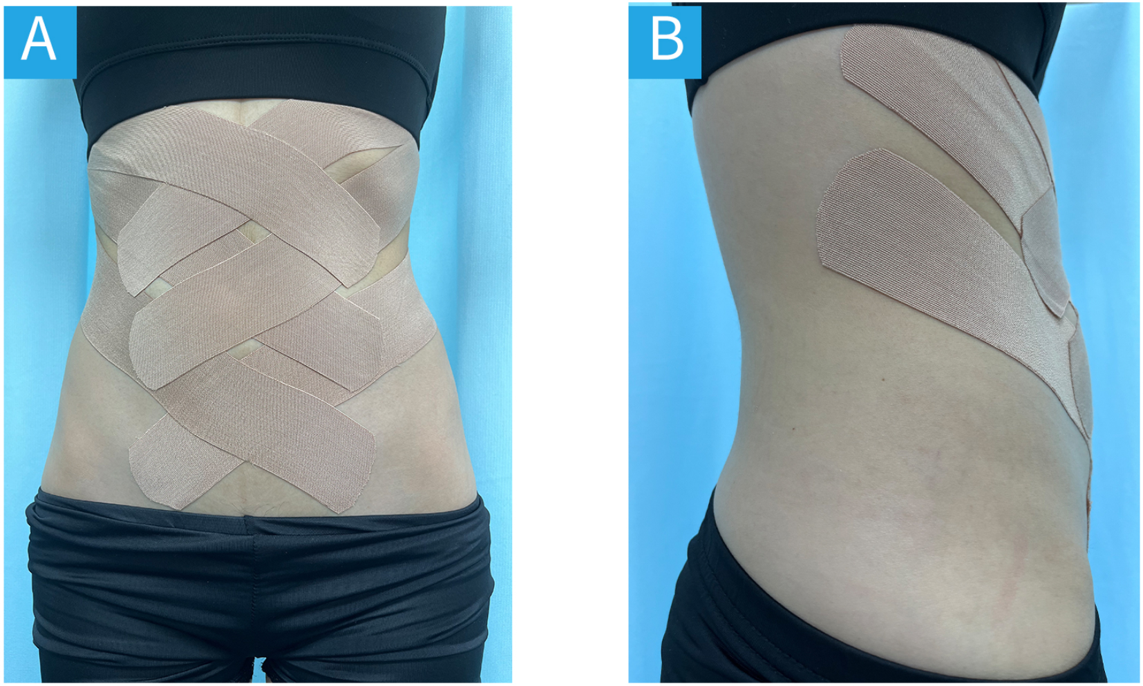 Neuroembryology of the Acupuncture Principal Meridians: Part 2. The Trunk |  Medical Acupuncture, image size:1654x994