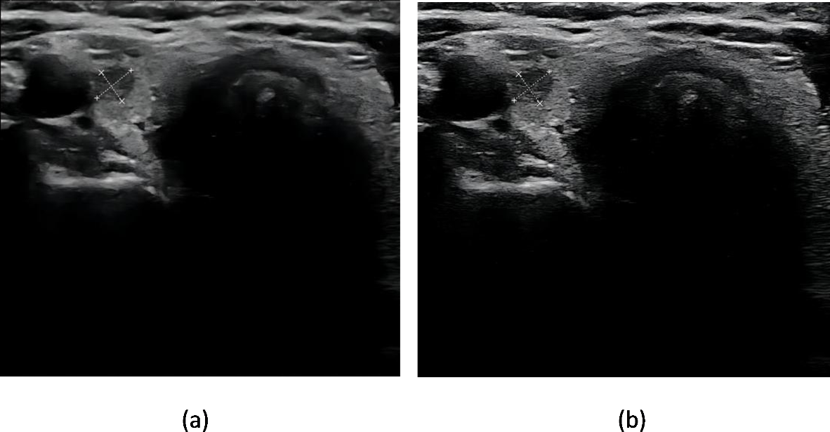 Fig. 10