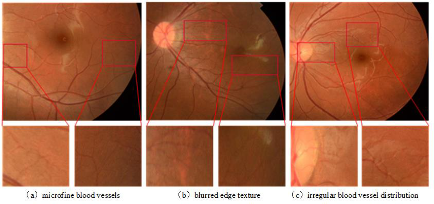 An effective vessel segmentation method using SLOA-HGC