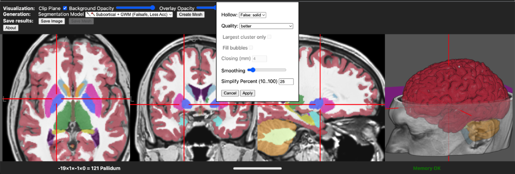 brain2print AI powered web tool for creating 3D printable brain models |  Scientific Reports