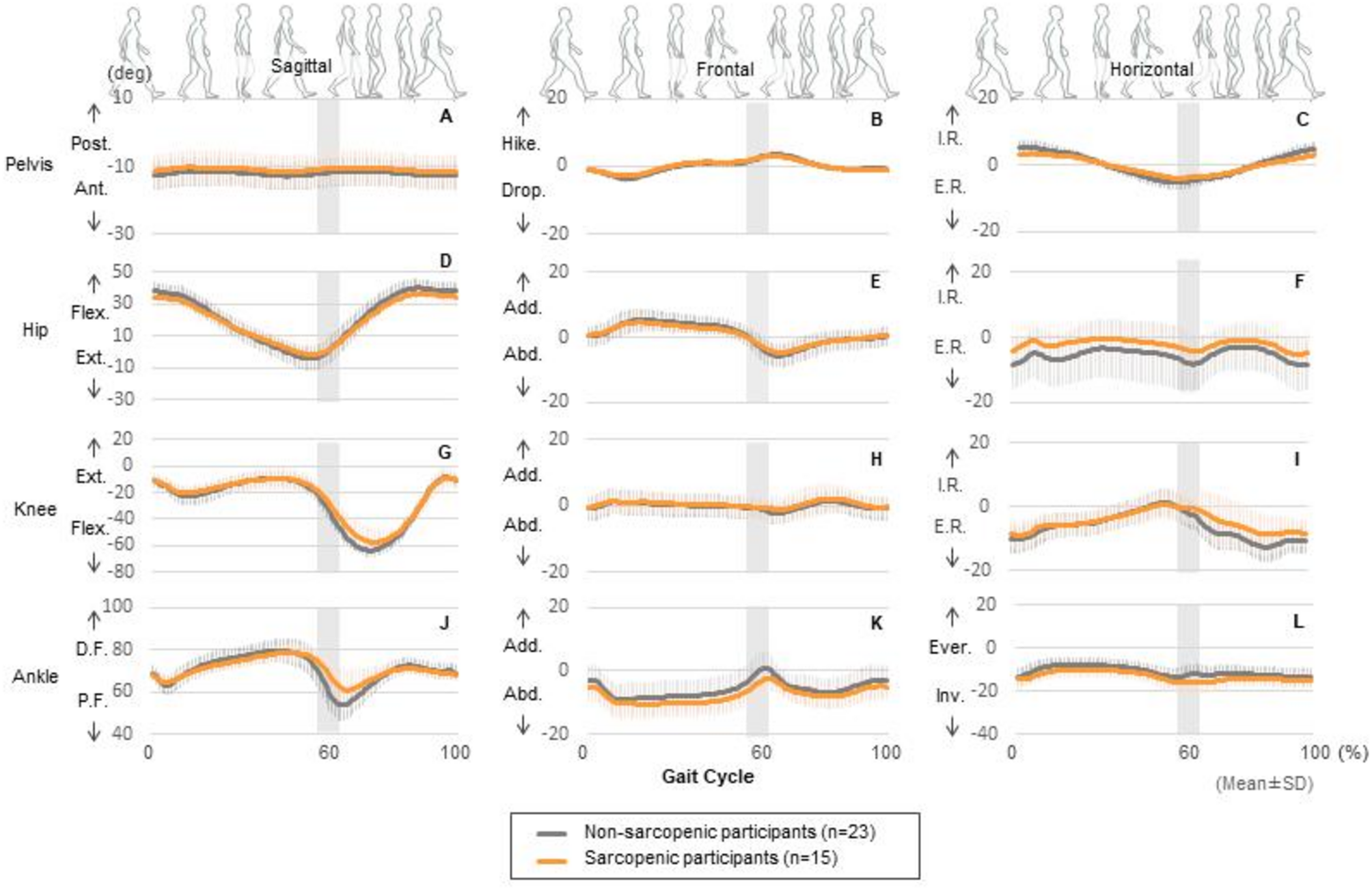Spatiotemporal and kinematic gait characteristics in older patients with  type 2 diabetes mellitus with and without sarcopenia | Scientific Reports