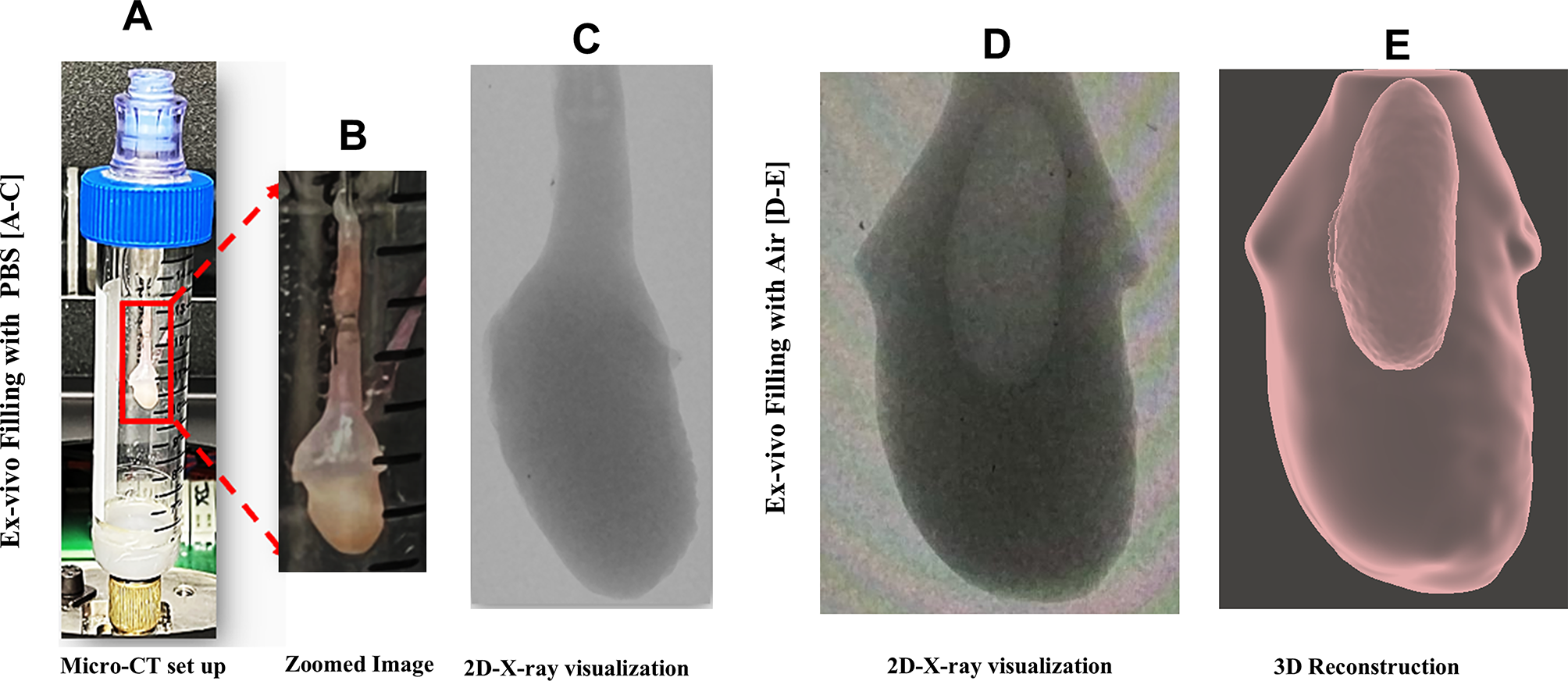 膀胱機能の真実を解明(Unfolding the truth about bladder function)