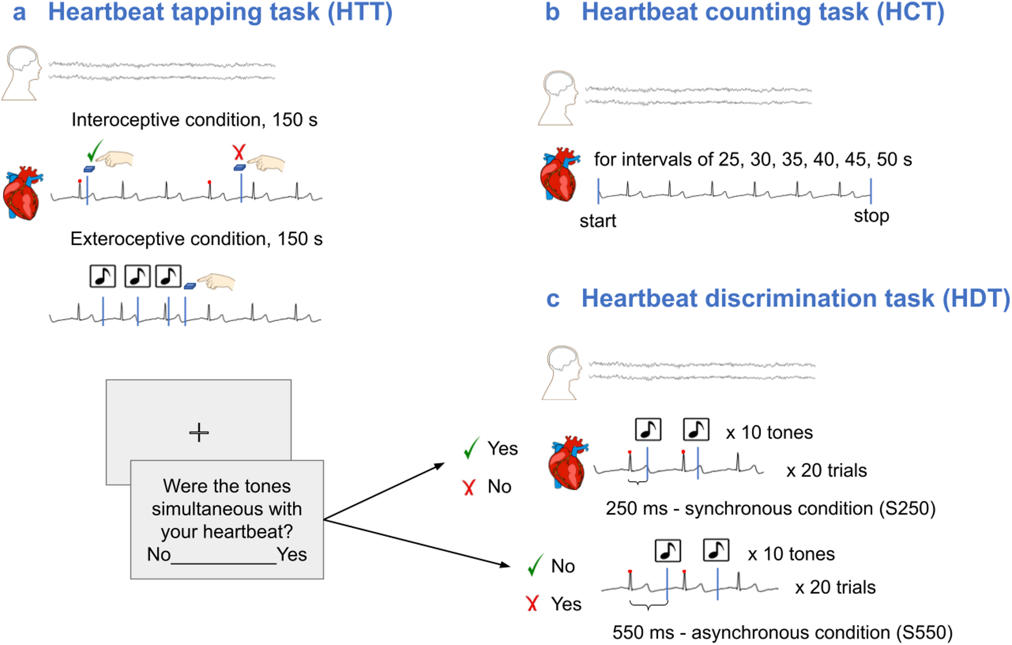 Comparison of three behavioral cardioception tasks and heartbeat evoked  potentials in the same group of healthy volunteers | Scientific Reports
