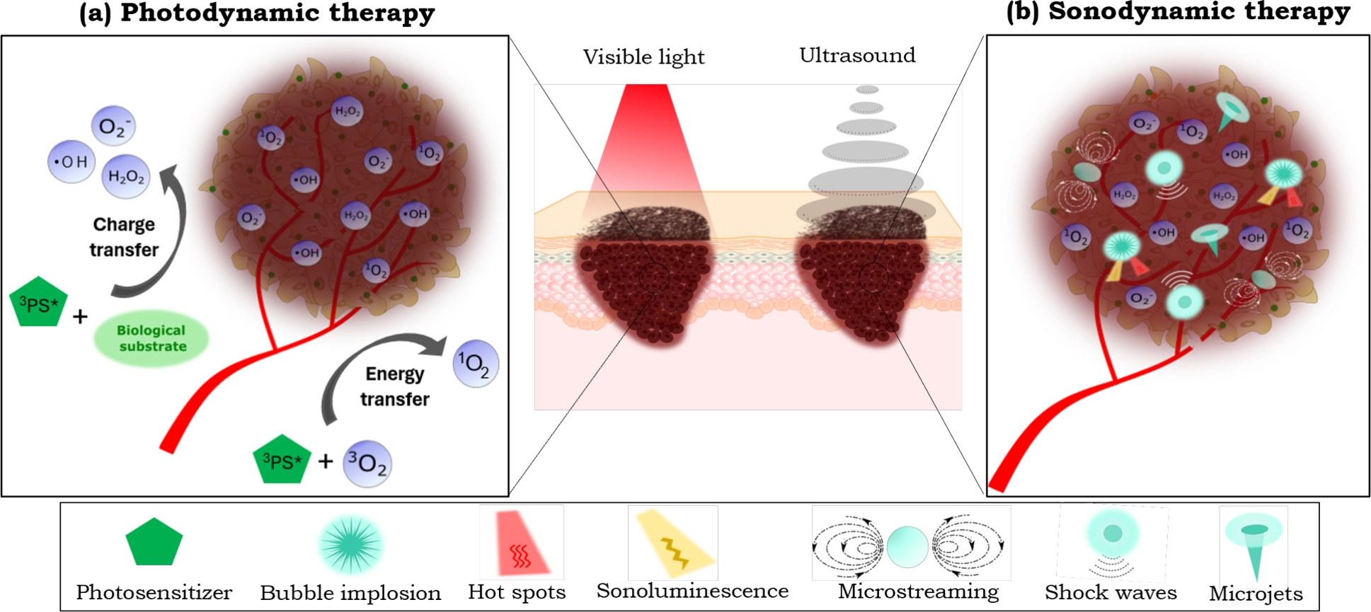 Comparative analysis of ALA mediated sonodynamic therapy considering tumor  size, light combination and ultrasound delivery in murine cutaneous  melanoma | Scientific Reports, image size:1937x865