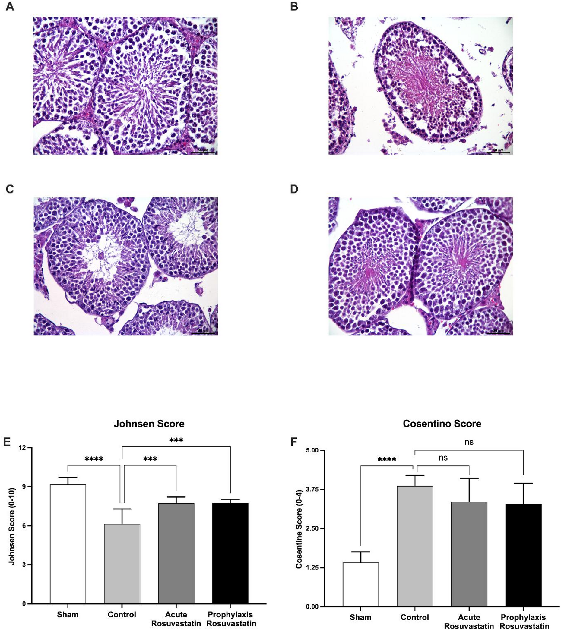 HMG-CoA reductase inhibition preserves testicular function after  torsion/detorsion by modulating oxidative stress and AKT signaling |  Scientific Reports