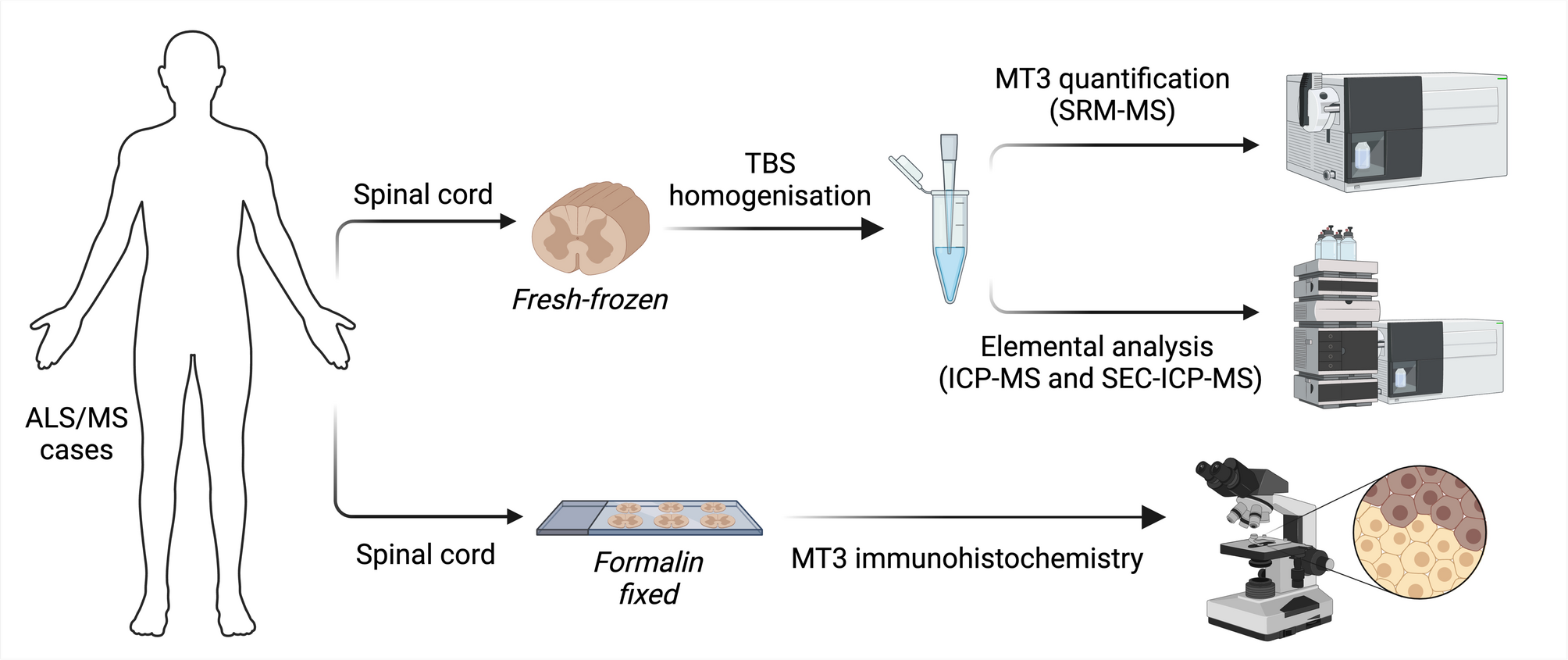 Decreased metallothionein-3 expression in the human spinal cord is a common feature of amyotrophic lateral sclerosis and multiple sclerosis | Scientific Reports Decreased metallothionein-3 expression in the human spinal cord is a common feature of amyotrophic lateral sclerosis and multiple sclerosis | Scientific Reports