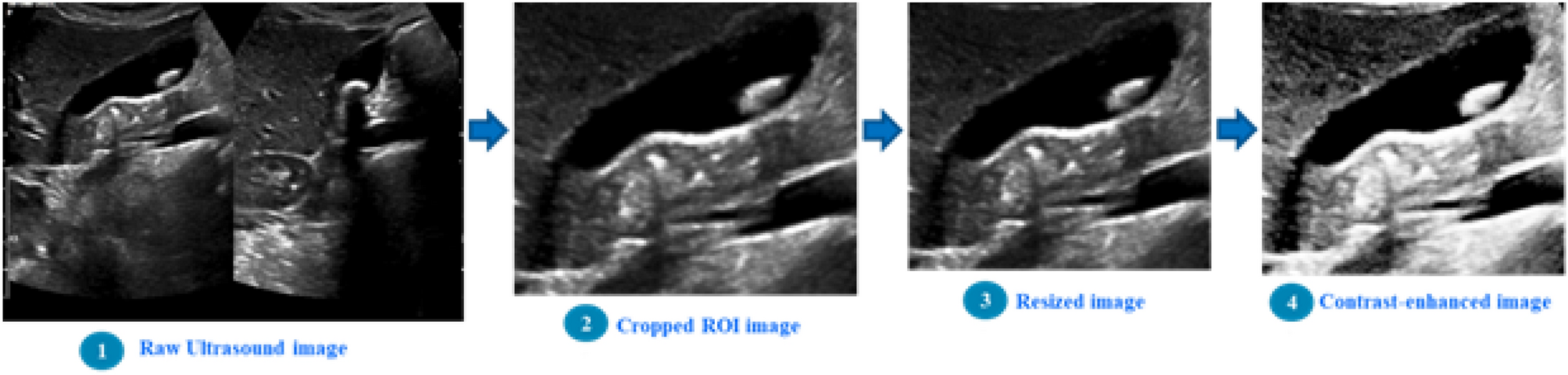 Fig. 4