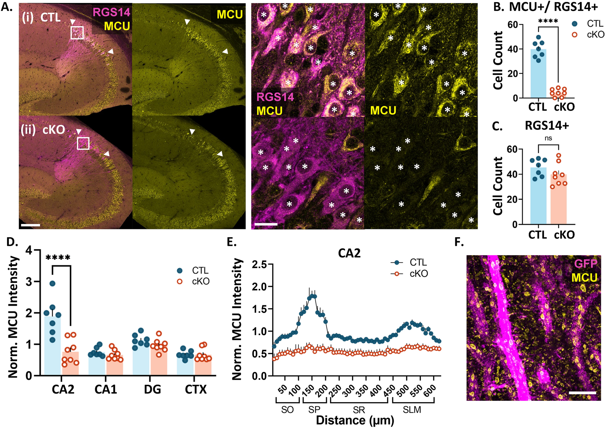 神経科学者が記憶回路の形成におけるミトコンドリアの役割を解明 (Virginia Tech neuroscientists discover mitochondria’s role in shaping memory circuits) 神経科学者が記憶回路の形成におけるミトコンドリアの役割を解明 (Virginia Tech neuroscientists discover mitochondria’s role in shaping memory circuits)