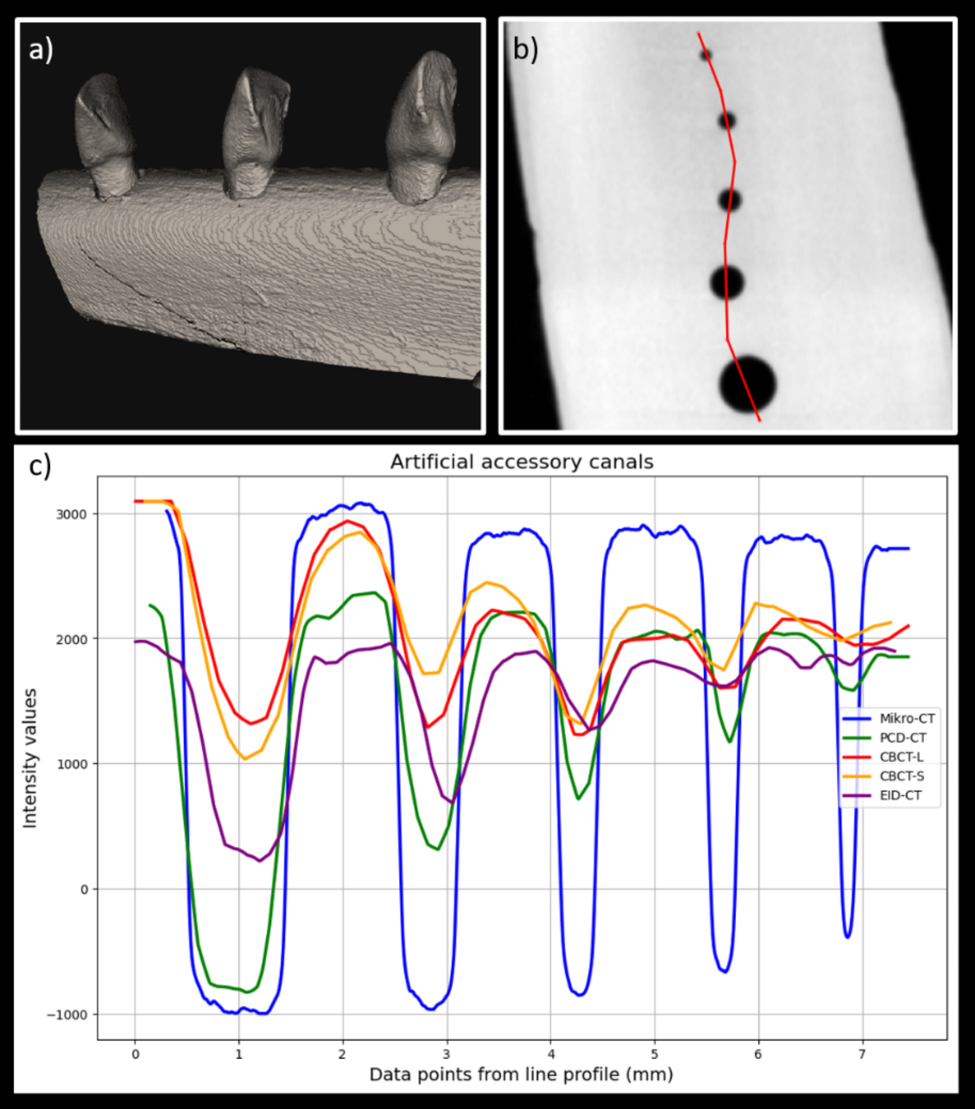 Photon-counting-detector CT outperforms state-of-the-art cone-beam and energy-integrated-detector CT in delineation of dental root canals