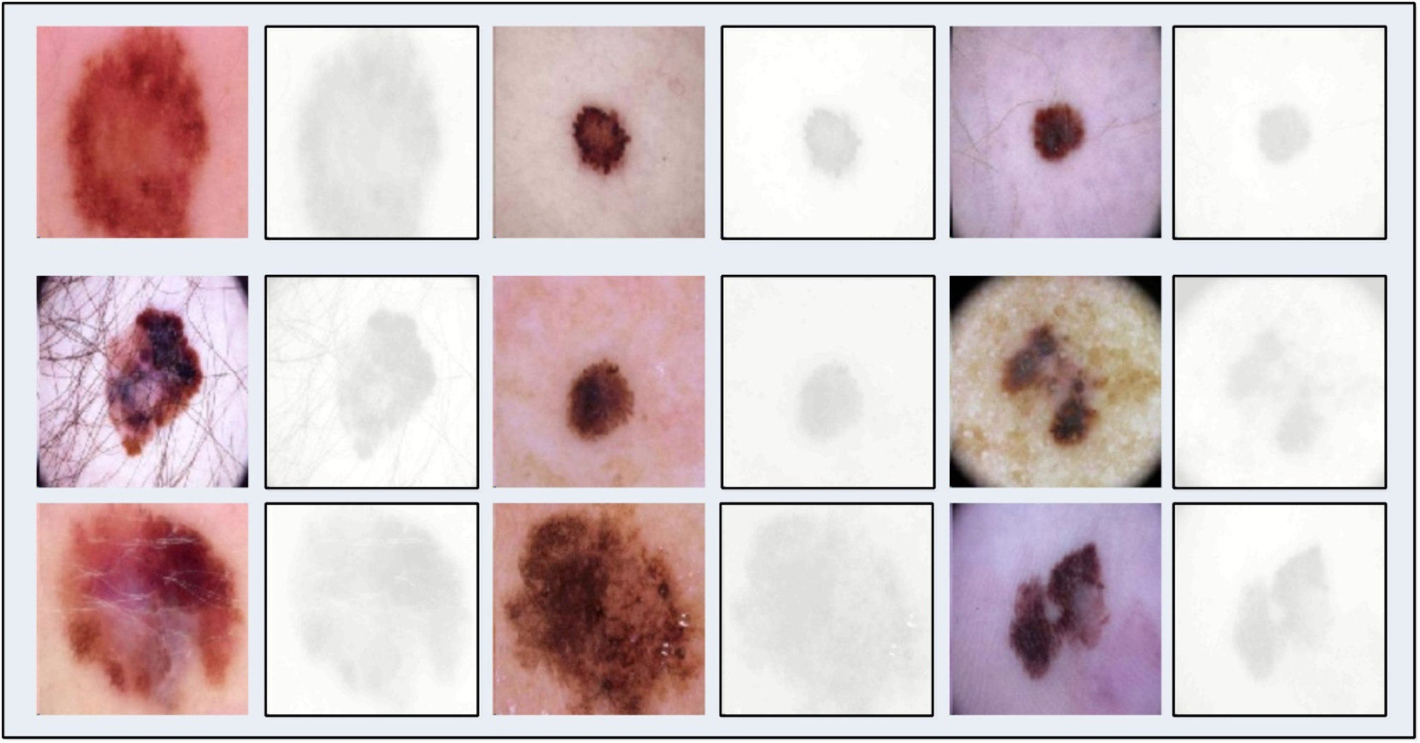 Fig. 14