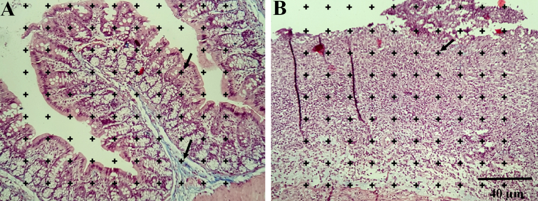 Antioxidant and anti-inflammatory effects of Equisetum arvense L. on  acid-induced ulcerative colitis in rats | Scientific Reports