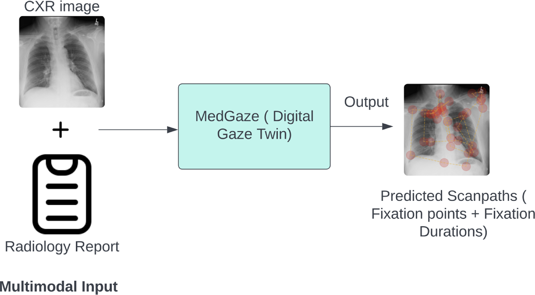 AIで放射線科医の視線を予測しトレーニングを革新(UH Researcher Launches New Era in Radiology Training)