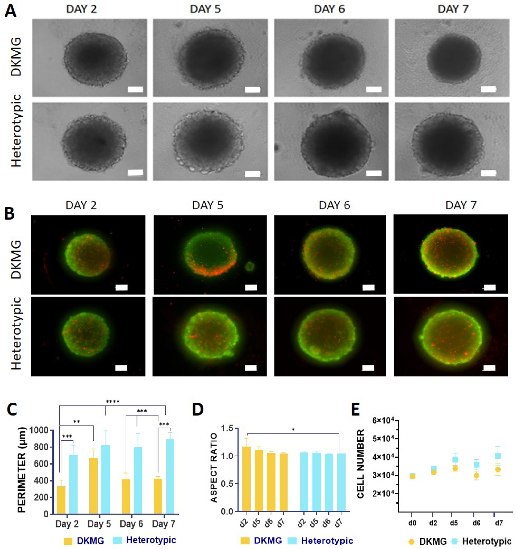 3D heterotypic models of glioblastoma reveal the impact of 