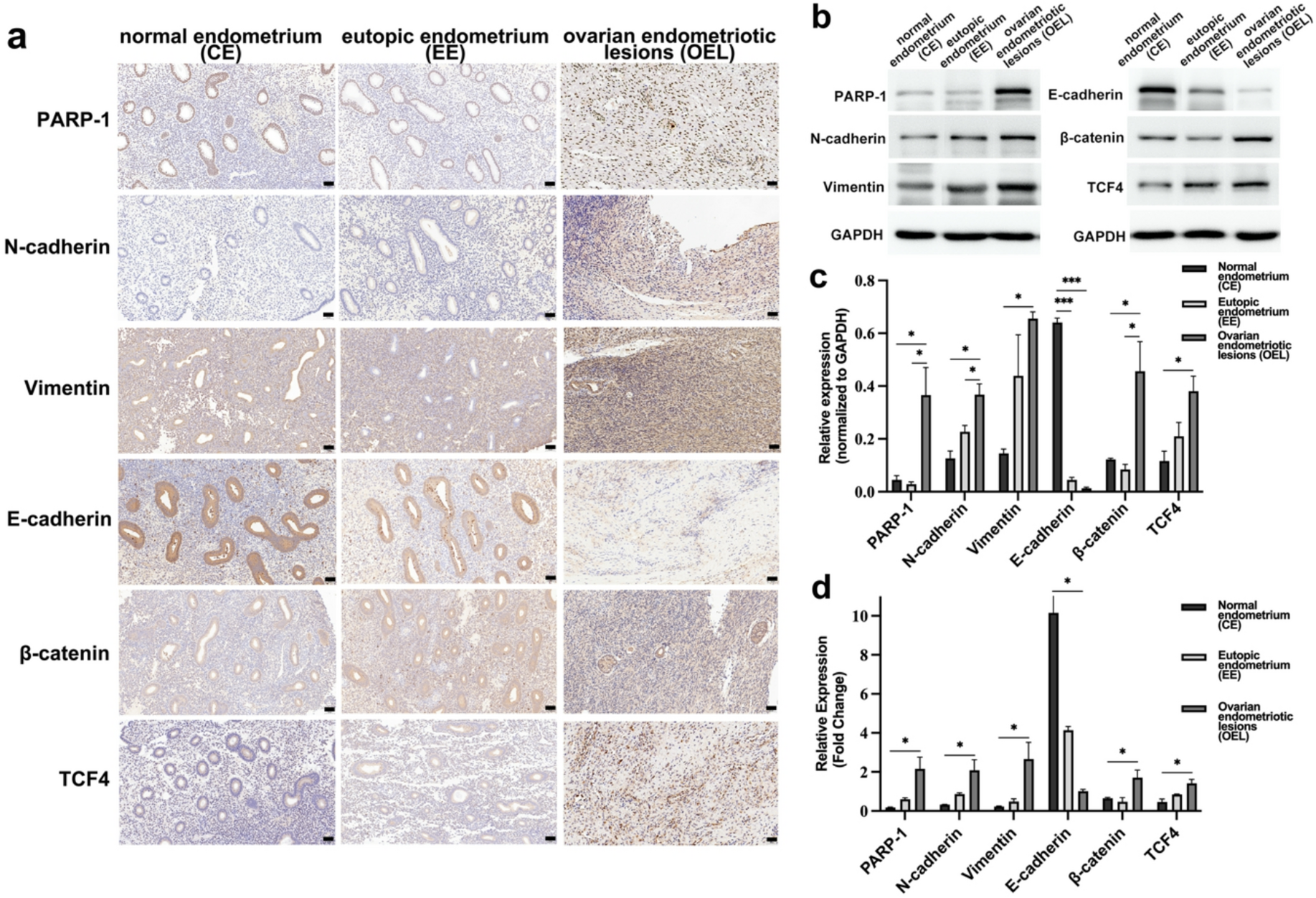PARP-1 couples β-catenin/TCF4 signaling to epithelial–mesenchymal  transition in endometriosis