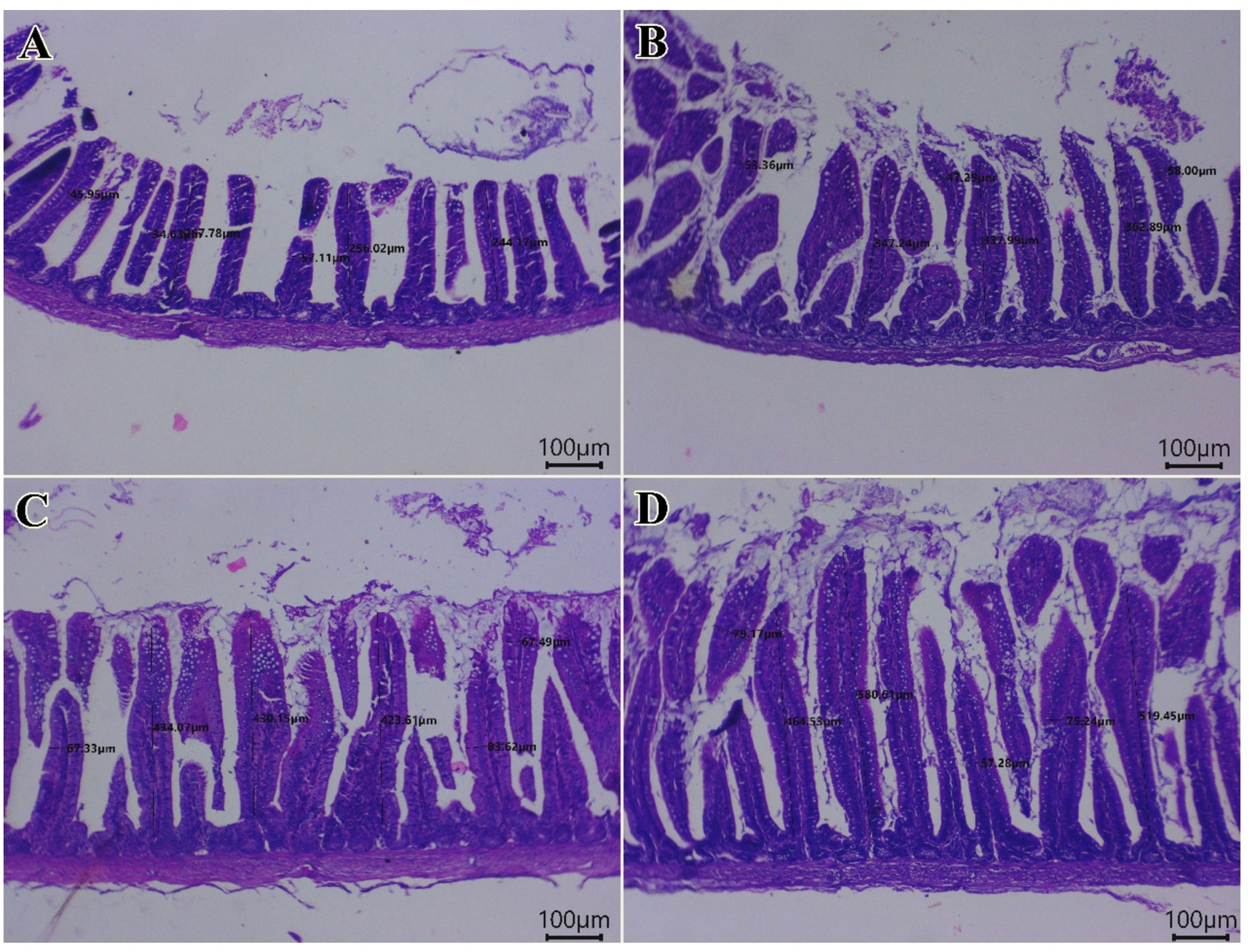 glutathione for diabetes The Roles of Glutathione and Oxidative Stress in Diabetes and COVID-19