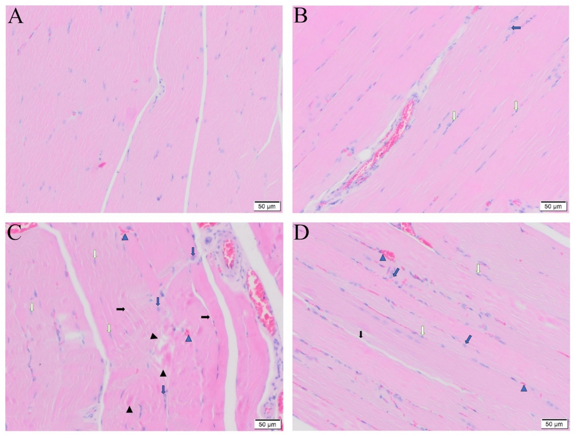 Protective effects of BPC 157 in rats with experimentally induced lower extremity ischemia-reperfusion injury