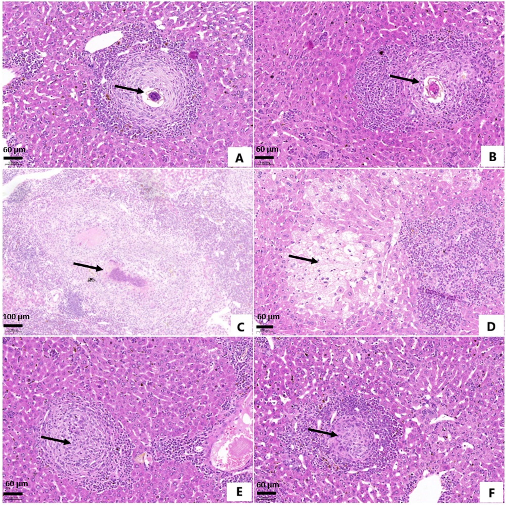 subq glutathione effects on kidneys and liver Protective efficacy of dapagliflozin against schistosomiasis  mansoni-induced liver pathology: an in vivo study