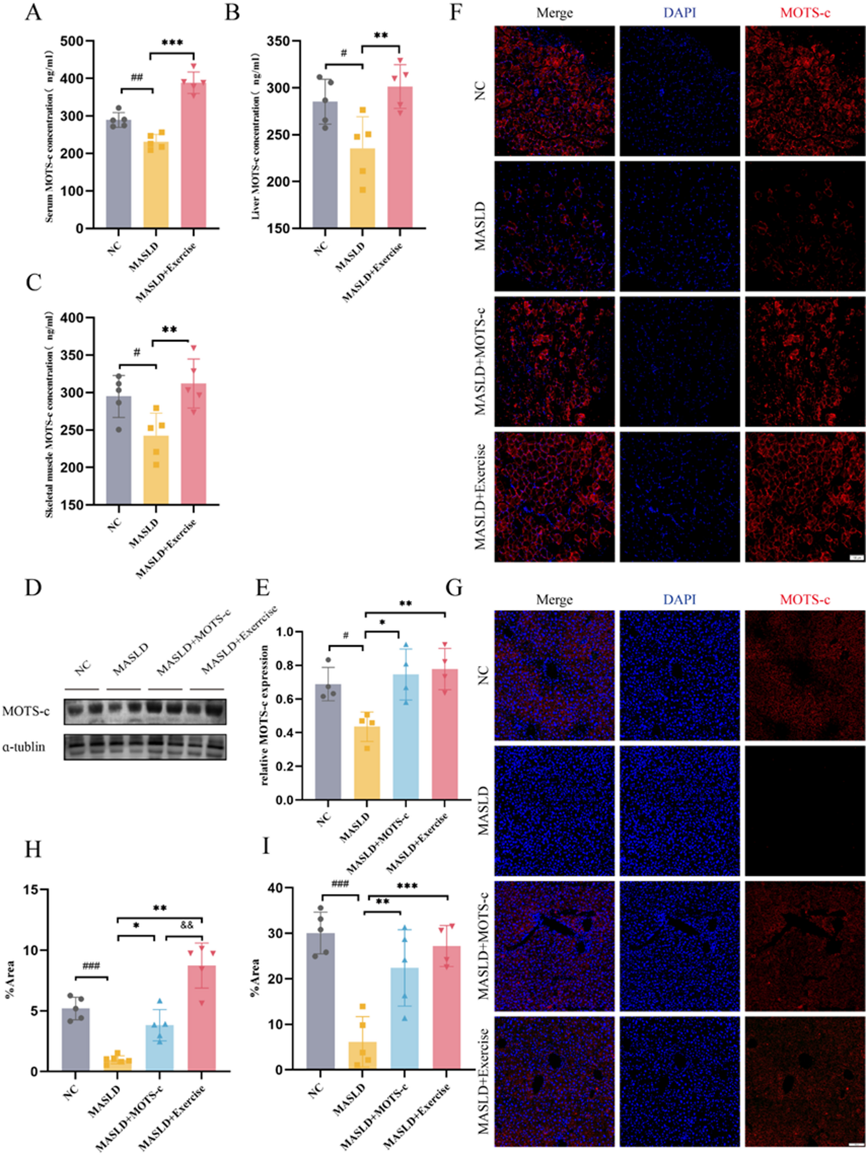 Aerobic exercise induced skeletal muscle MOTS-c secretion: A novel therapy for MASLD via hepatic ACE2 regulation - Nature