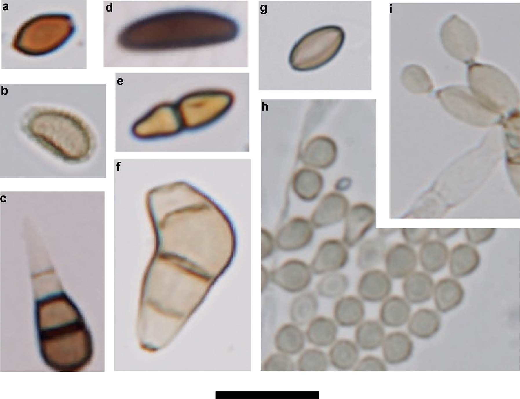 Fig. 2: Images of common fungal spores sampled at the different heights over the rainforest and identified up to family level.
