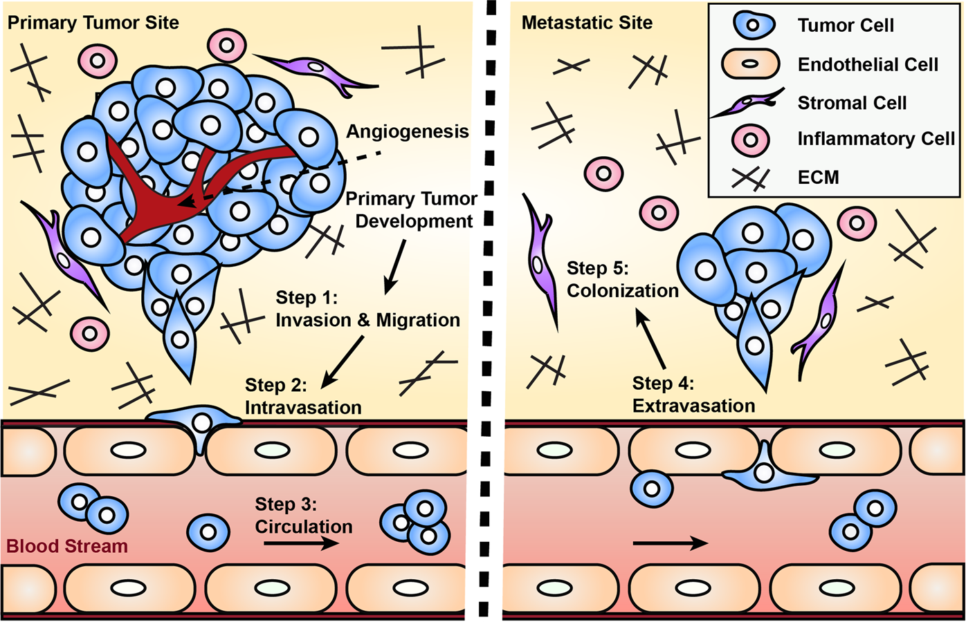 Engineered models to parse apart the metastatic cascade | npj Precision  Oncology