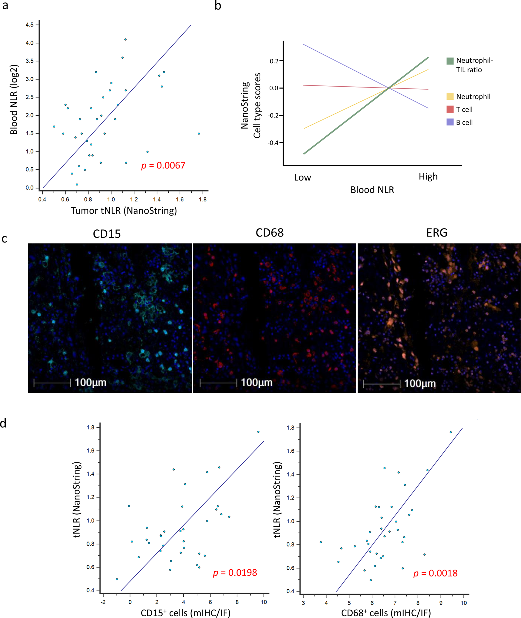 Fig. 5: Correlation of peripheral blood NLR with tNLR.