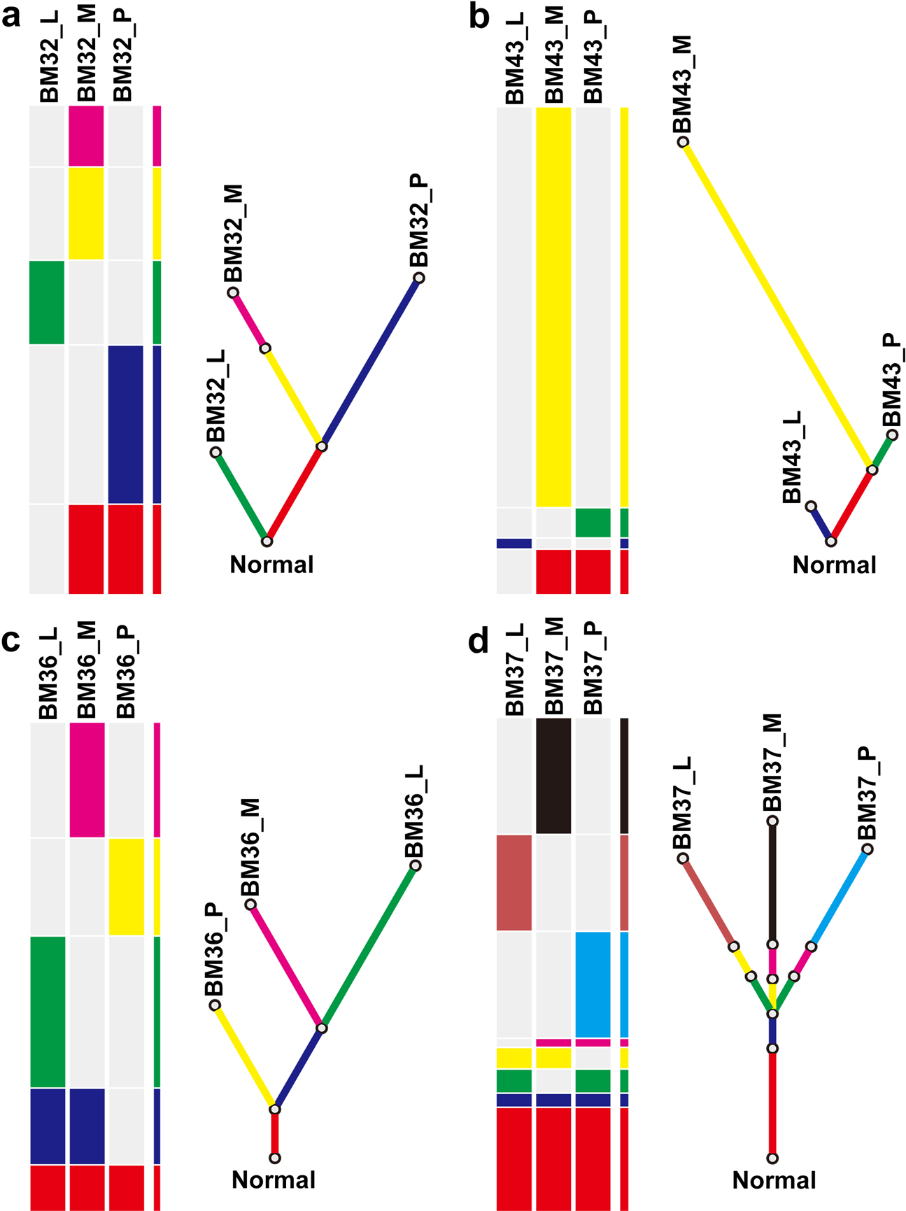 Fig. 4: Phylogenetic tree of four cases with synchronous lymphatic and brain metastases.