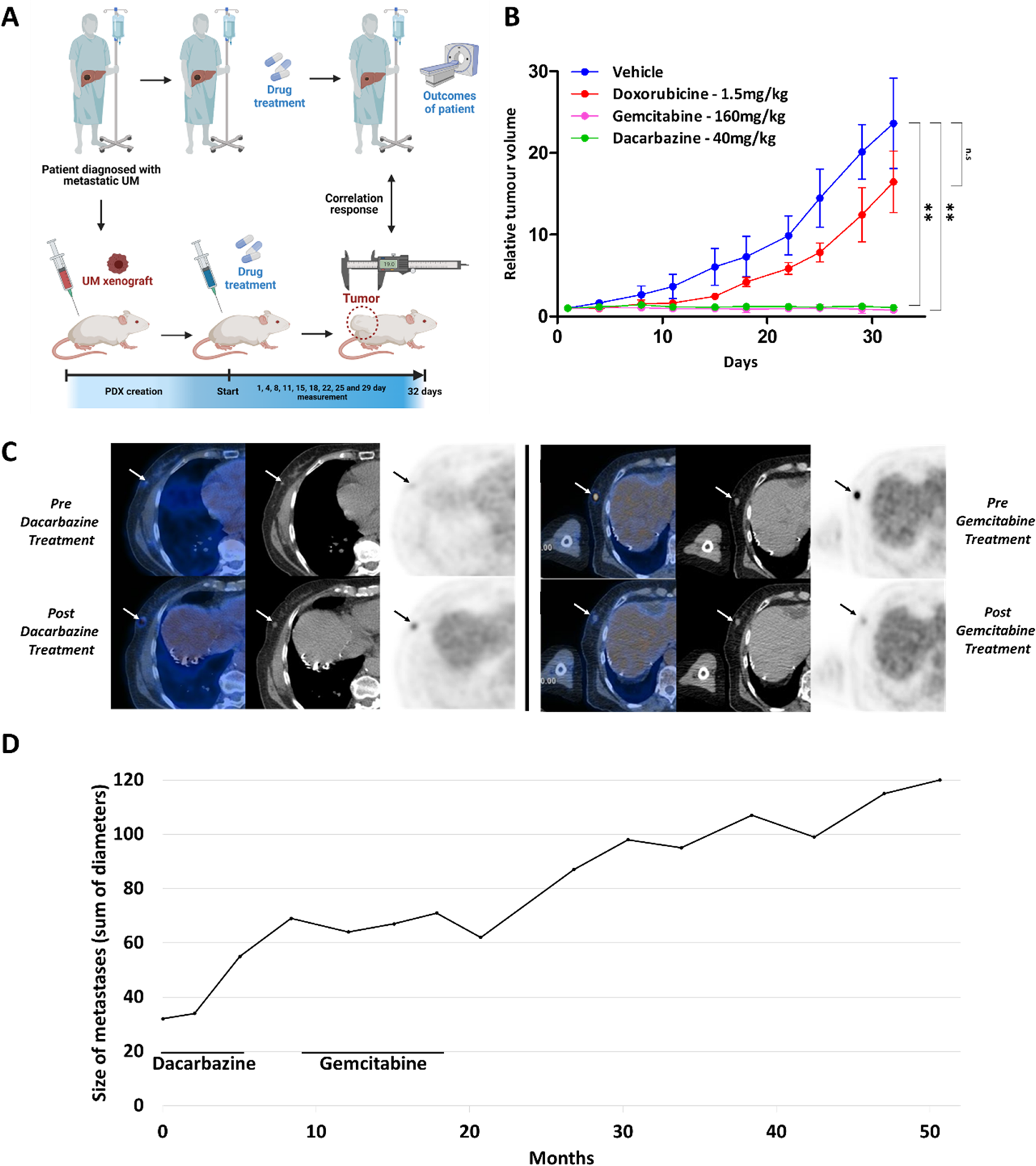 Fig. 4: Activity of gemcitabine in an MBD4-deficient UM patient-derived xenograft (PDX) model and in the corresponding metastatic patient.