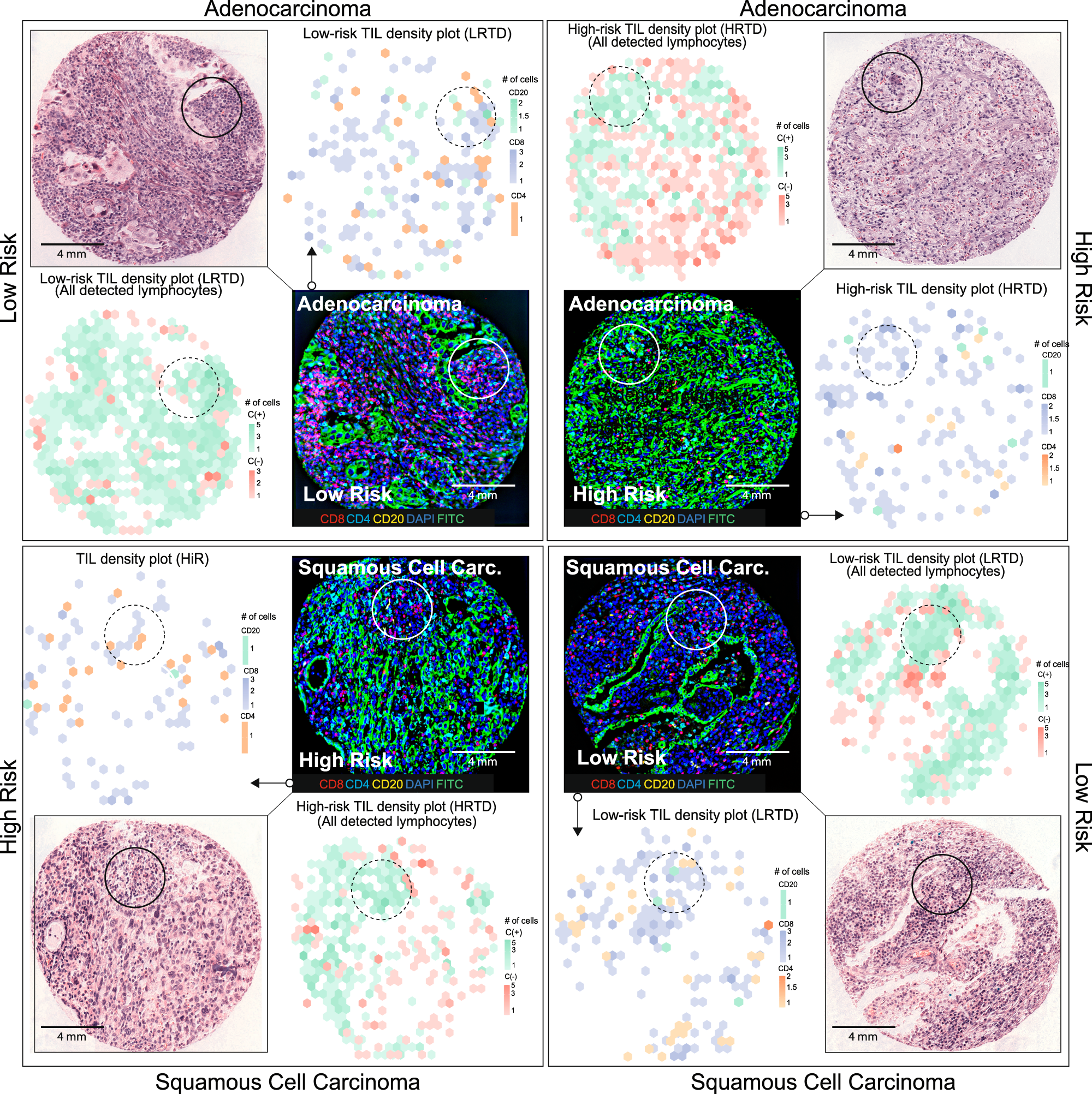 Fig. 5: The density plots of TIL subtypes and cluster groups for lung AD and SCC are displayed alongside their corresponding H&E-stained and IF TMAs.