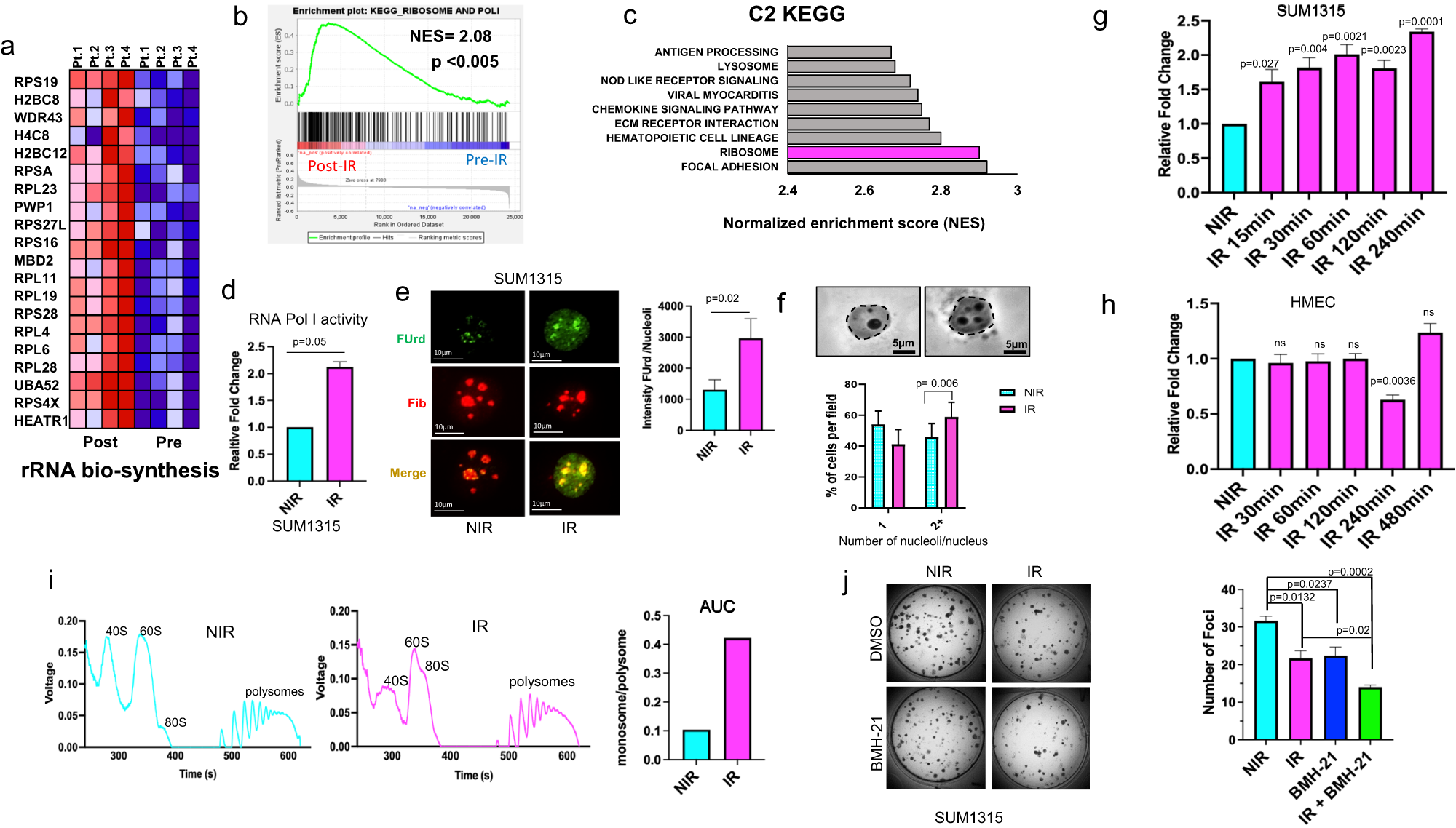 Ribosome biosynthesis and Hedgehog activity are cooperative actionable  signaling mechanisms in breast cancer following radiotherapy | npj  Precision Oncology
