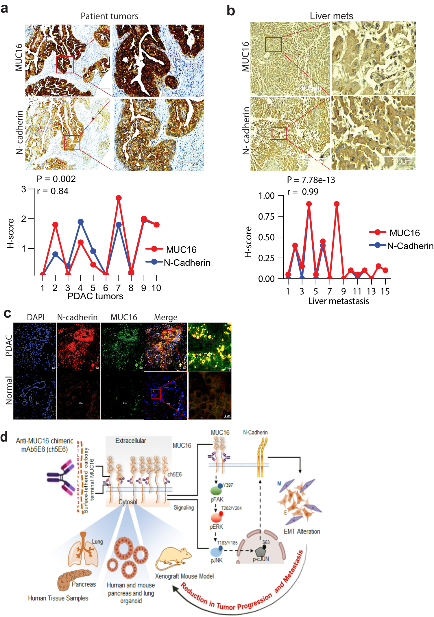 Fig. 7: MUC16 and N-cadherin are clinically correlated in patient tumors.