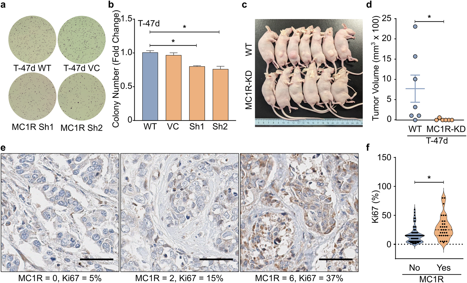 Fig. 3: MC1R promotes tumorigenicity and breast cancer progression in vitro and in vivo.