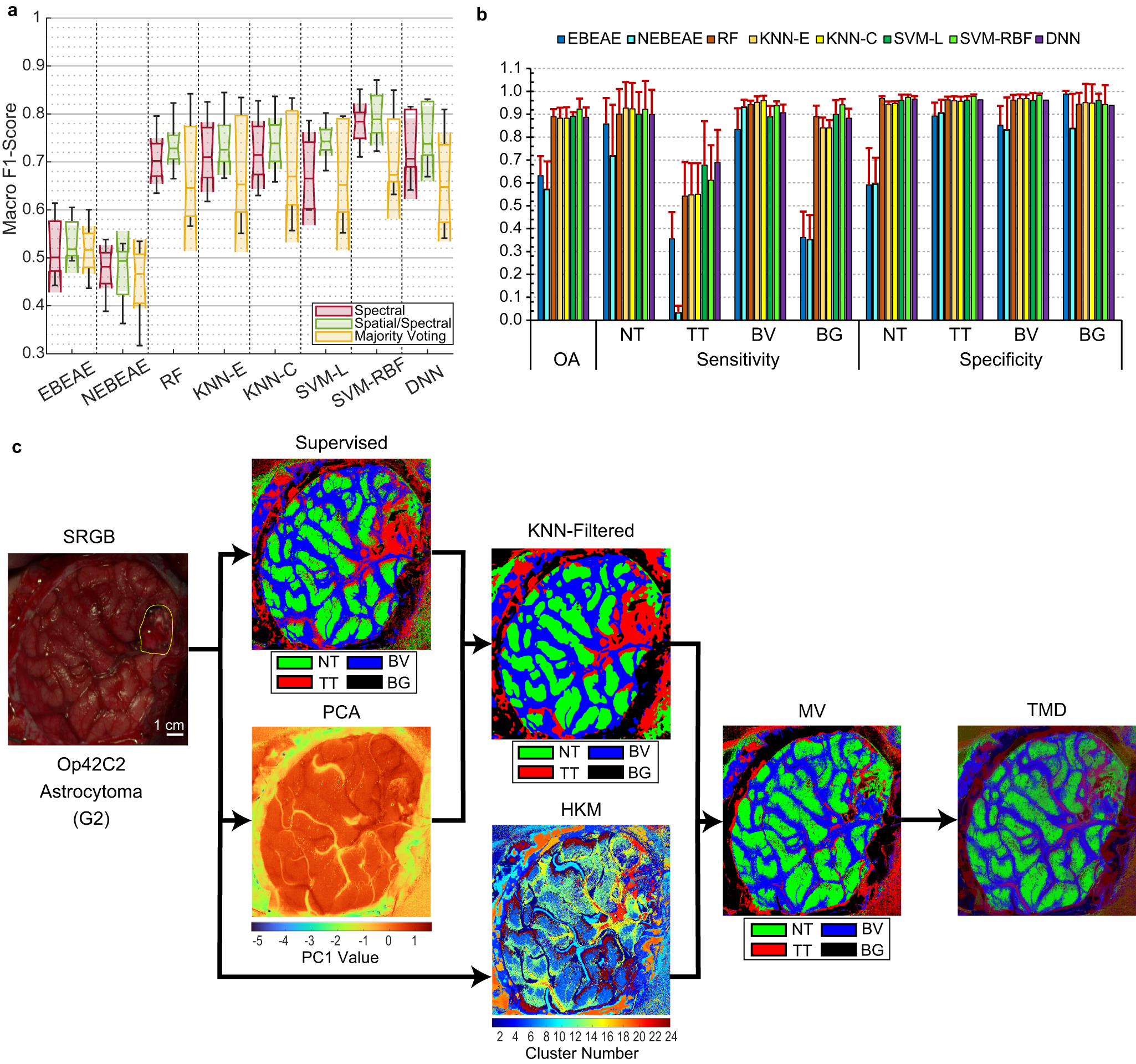 Fig. 5: Quantitative and qualitative results at the different stages of the proposed framework in the validation set.