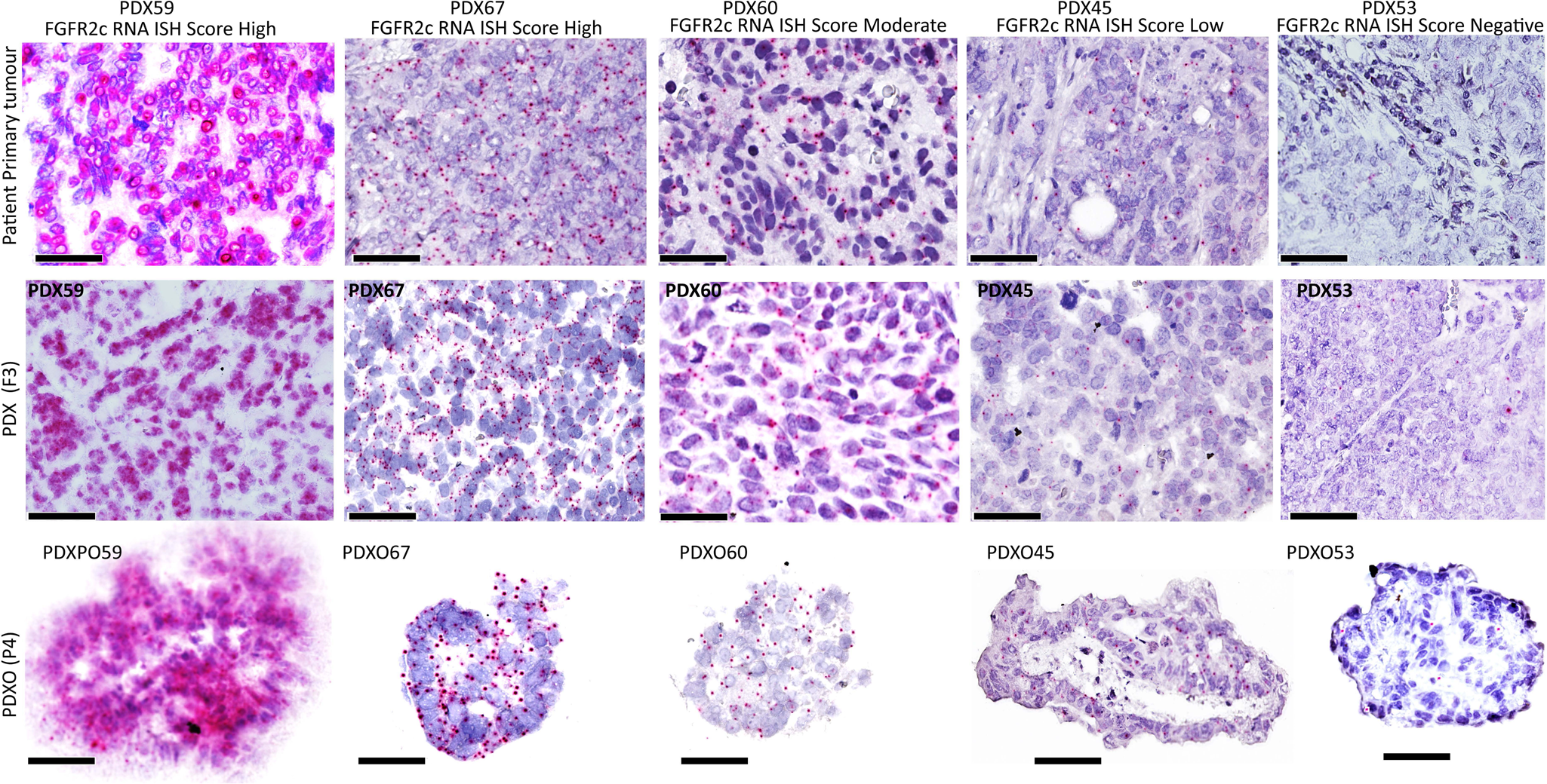 Fig. 2: Different levels of expression of FGFR2c revealed by RNA ISH showing FGFR2c expression in PDXs and PDXOs recapitulate corresponding patient tumours.
