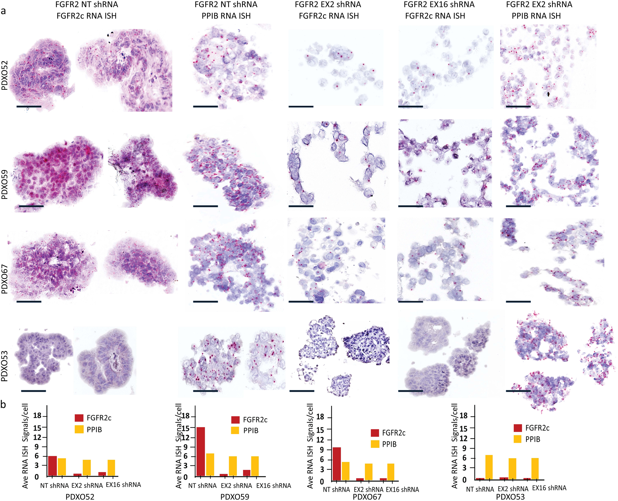 Fig. 6: FGFR2c expression relative to Peptidylprolyl isomerase B (PPIB) a housekeeping gene following FGFR2 shRNA mediated knockdown in four endometrial cancer PDXO models.