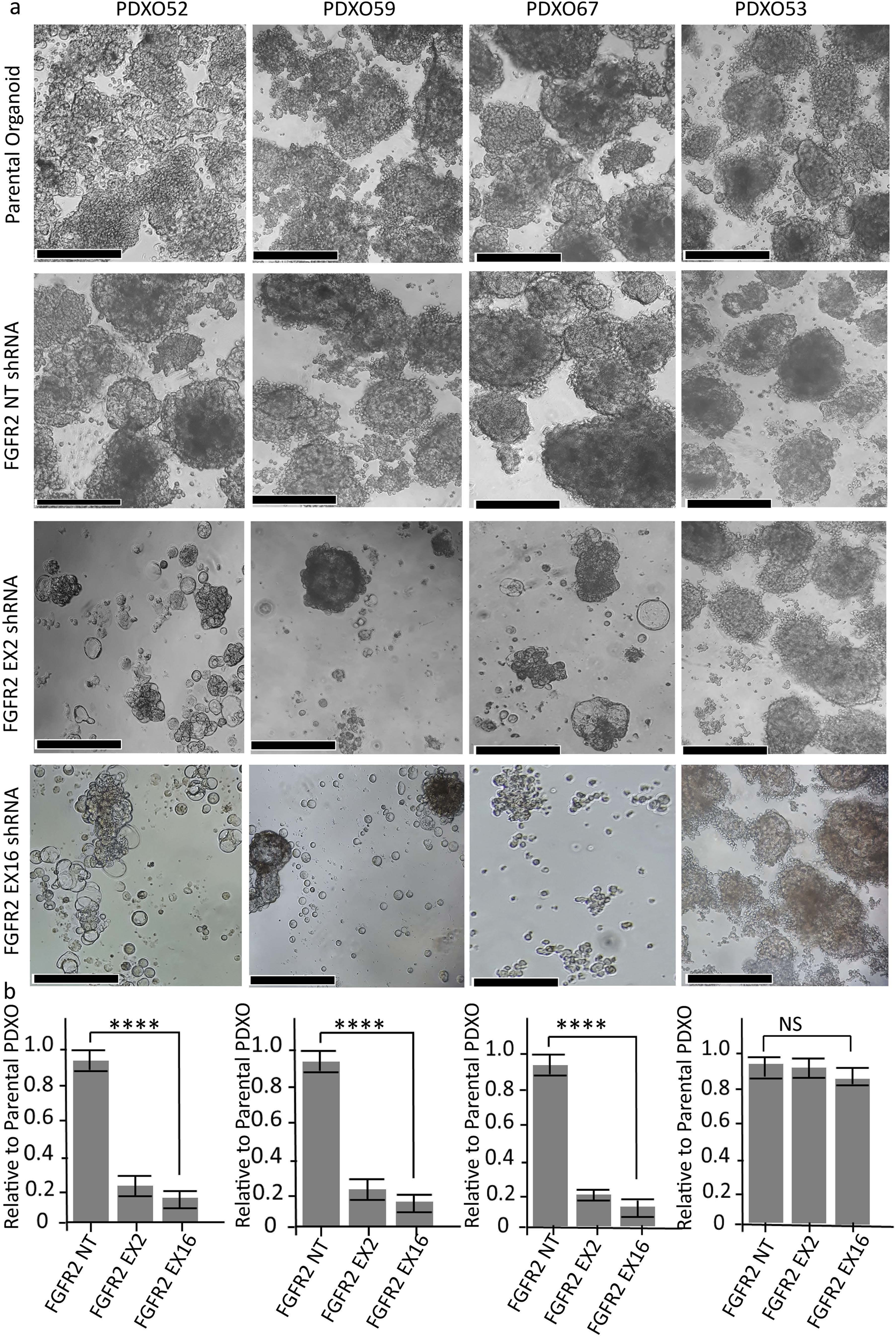 Fig. 7: shRNA mediated FGFR2 knockdown significantly reduces endometrial cancer PDXOs growth and viability.