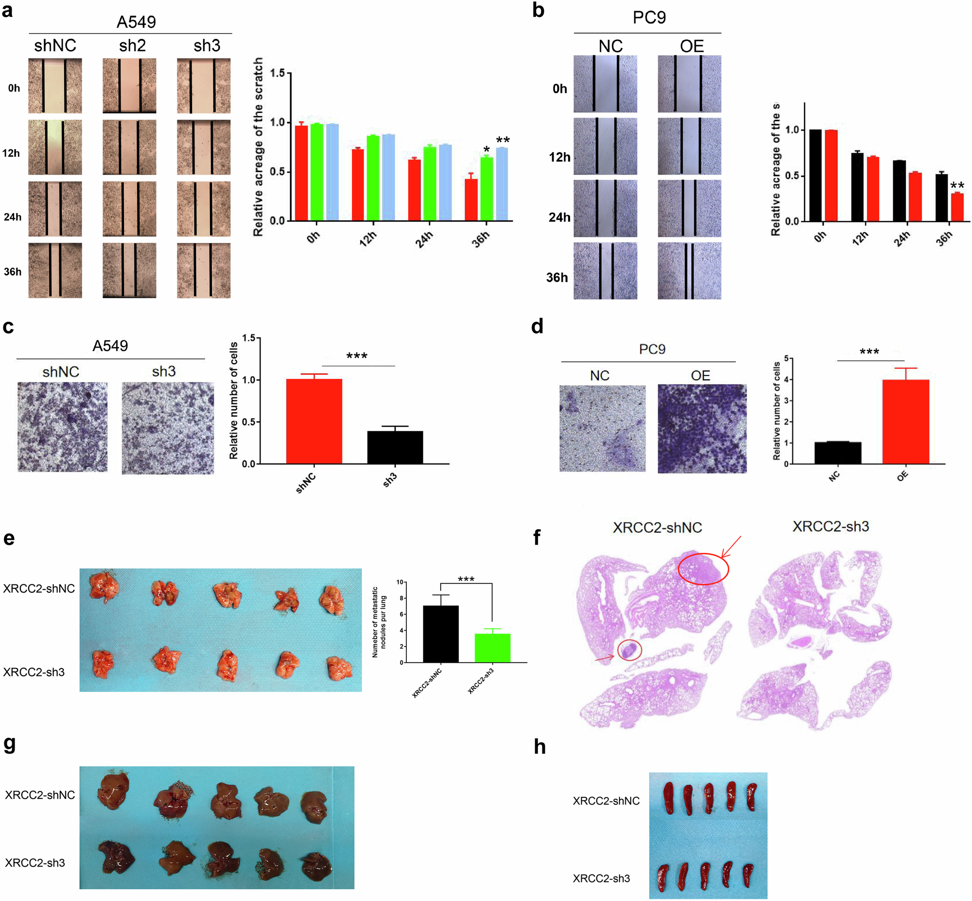 Fig. 7: XRCC2 promoted the migration and invasion of lung cancer cells.
