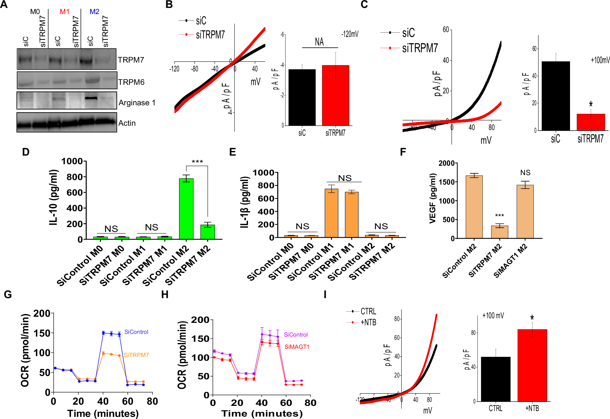 Fig. 6: TRPM7 channel is important for the M2 phenotype.