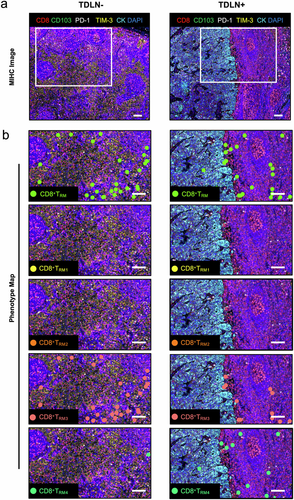 Fig. 3: Multiple immunohistochemical and cellular characterization images of negative tumor-draining lymph nodes (TDLN−) and positive TDLN (TDLN+).
