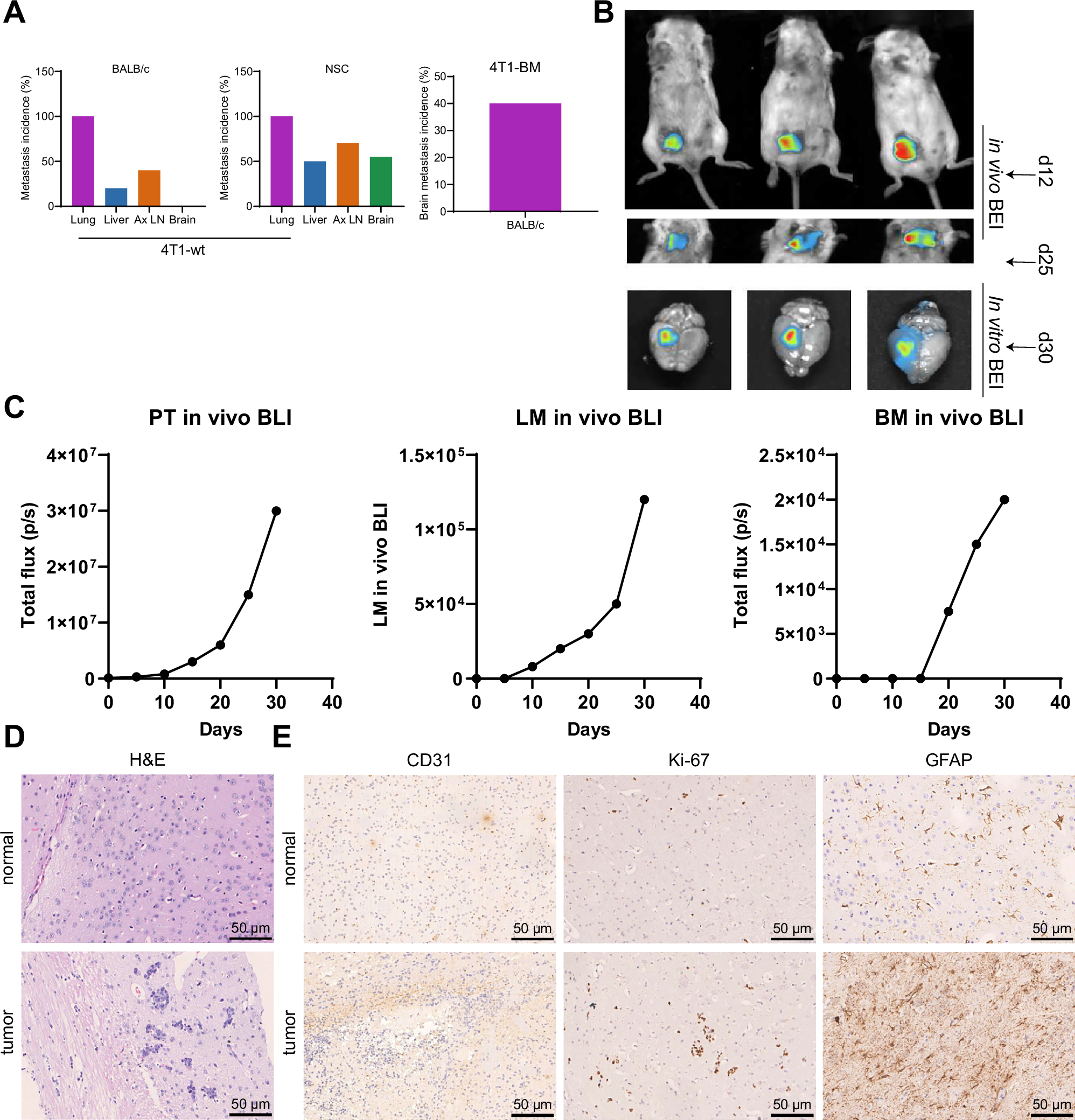 Role of GPX3+ astrocytes in breast cancer brain metastasis activated by  circulating tumor cell exosomes | npj Precision Oncology
