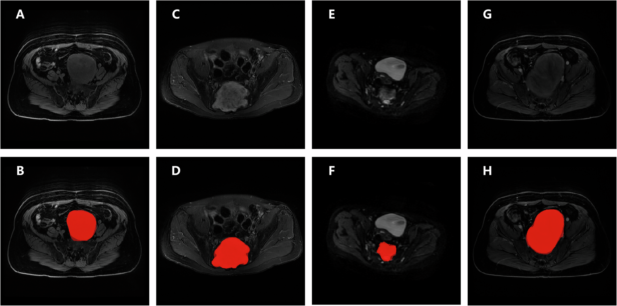 Fig. 1: Demonstration of the segmentation model’s predictions.