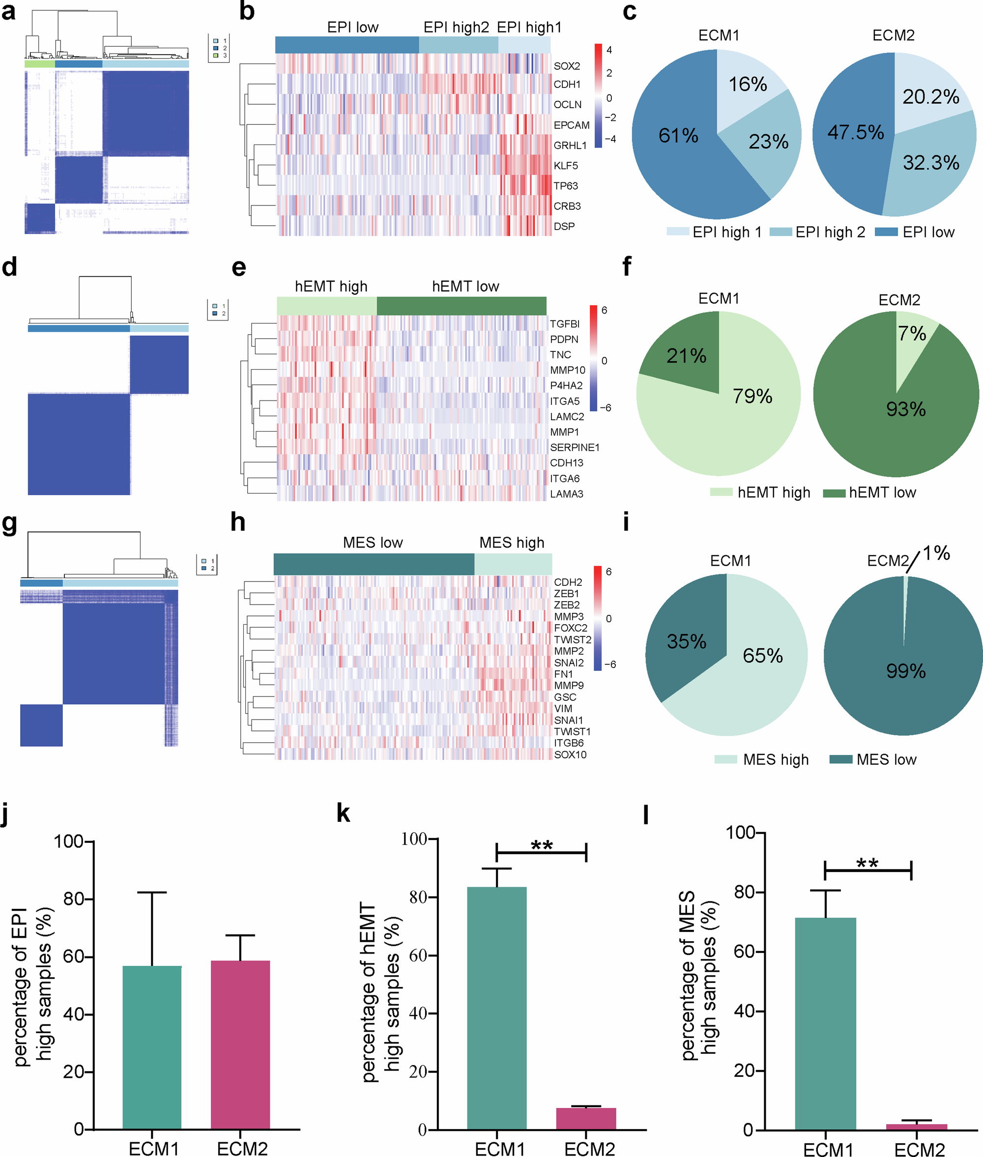 Fig. 7: Distribution of ECM1 and ECM2 subtypes across different EMT stages.
