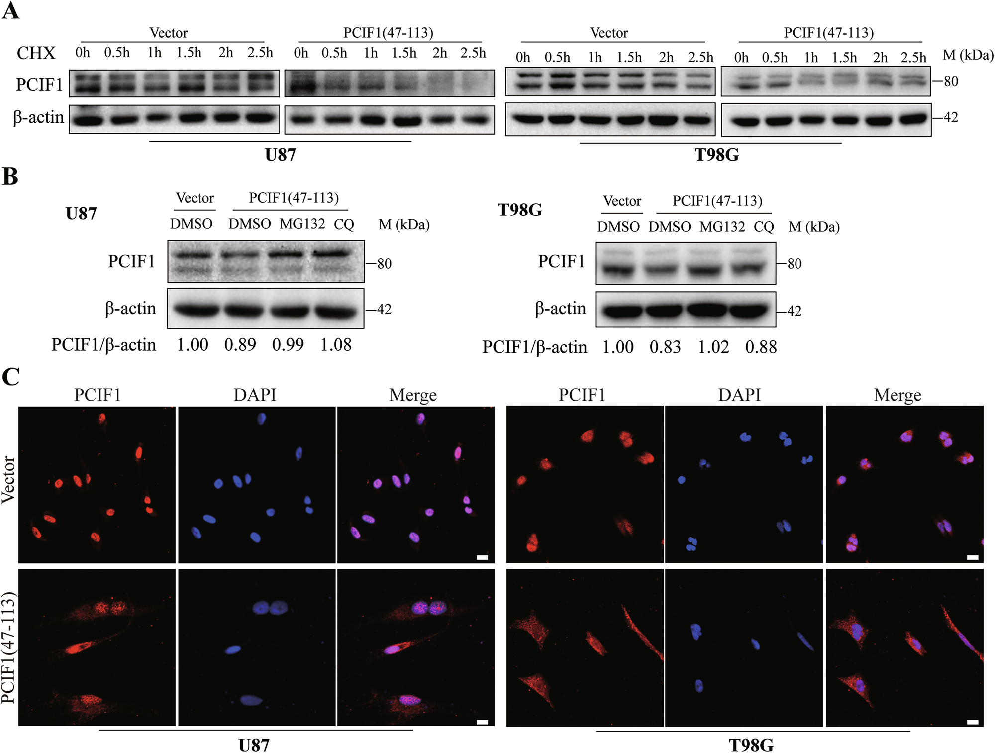 Fig. 6: Overexpression of the WW domain promotes the degradation of endogenous PCIF1 protein and facilitates its translocation from the nucleus to the cytoplasm.