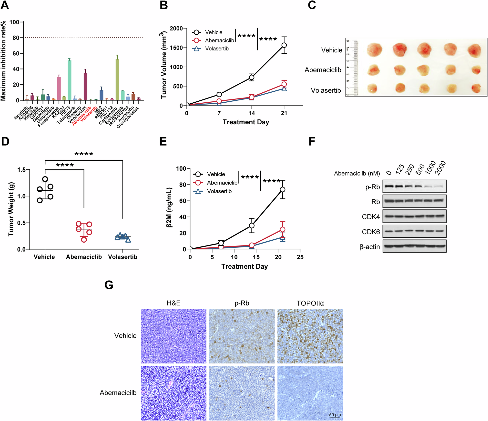 Fig. 4: Cell cycle-targeted agents were identified as a viable therapeutic strategy for MCL Patient 17.