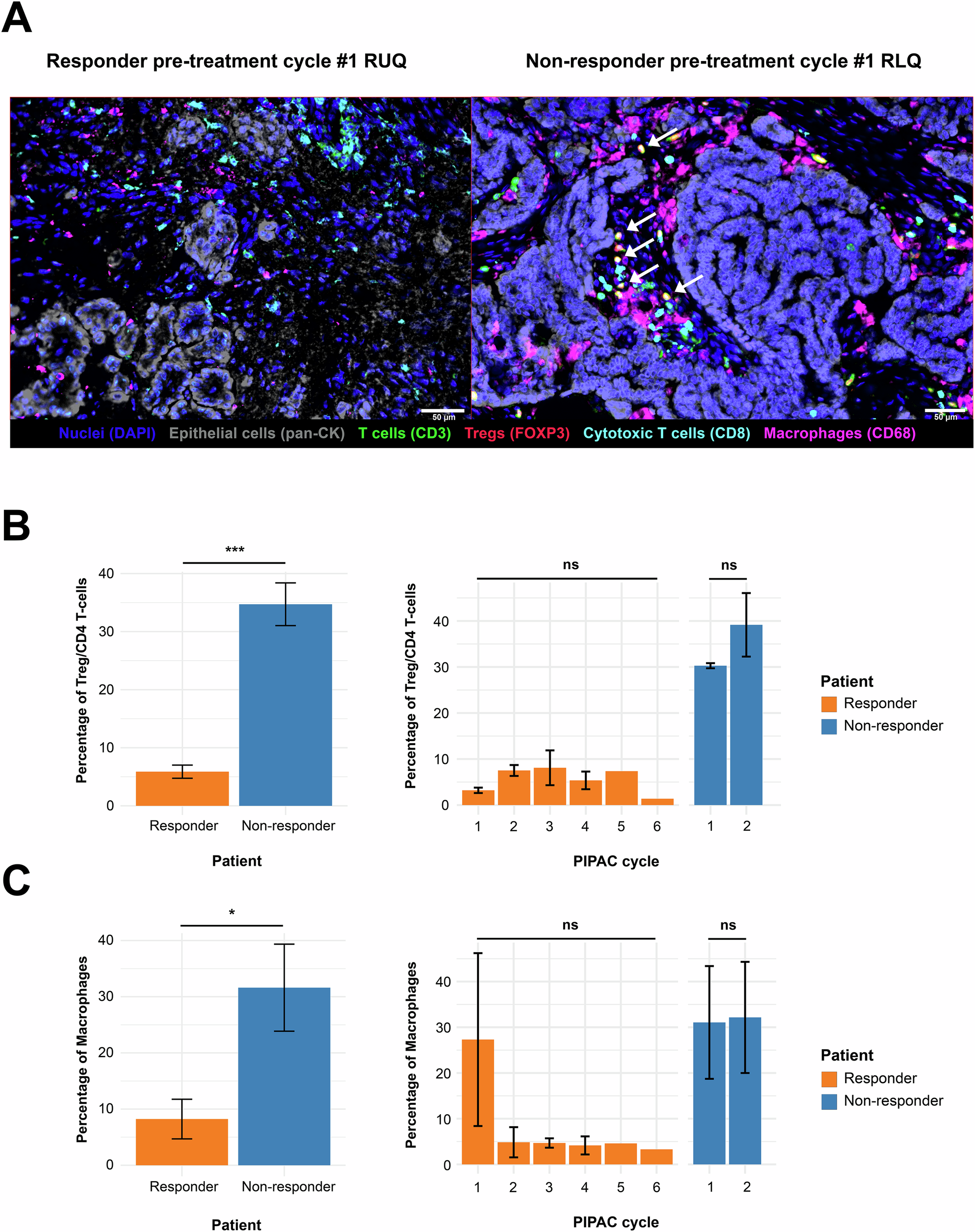 Fig. 4: Immunostaining analysis reveals distinct immune cell compositions in responder and non-responder patients.