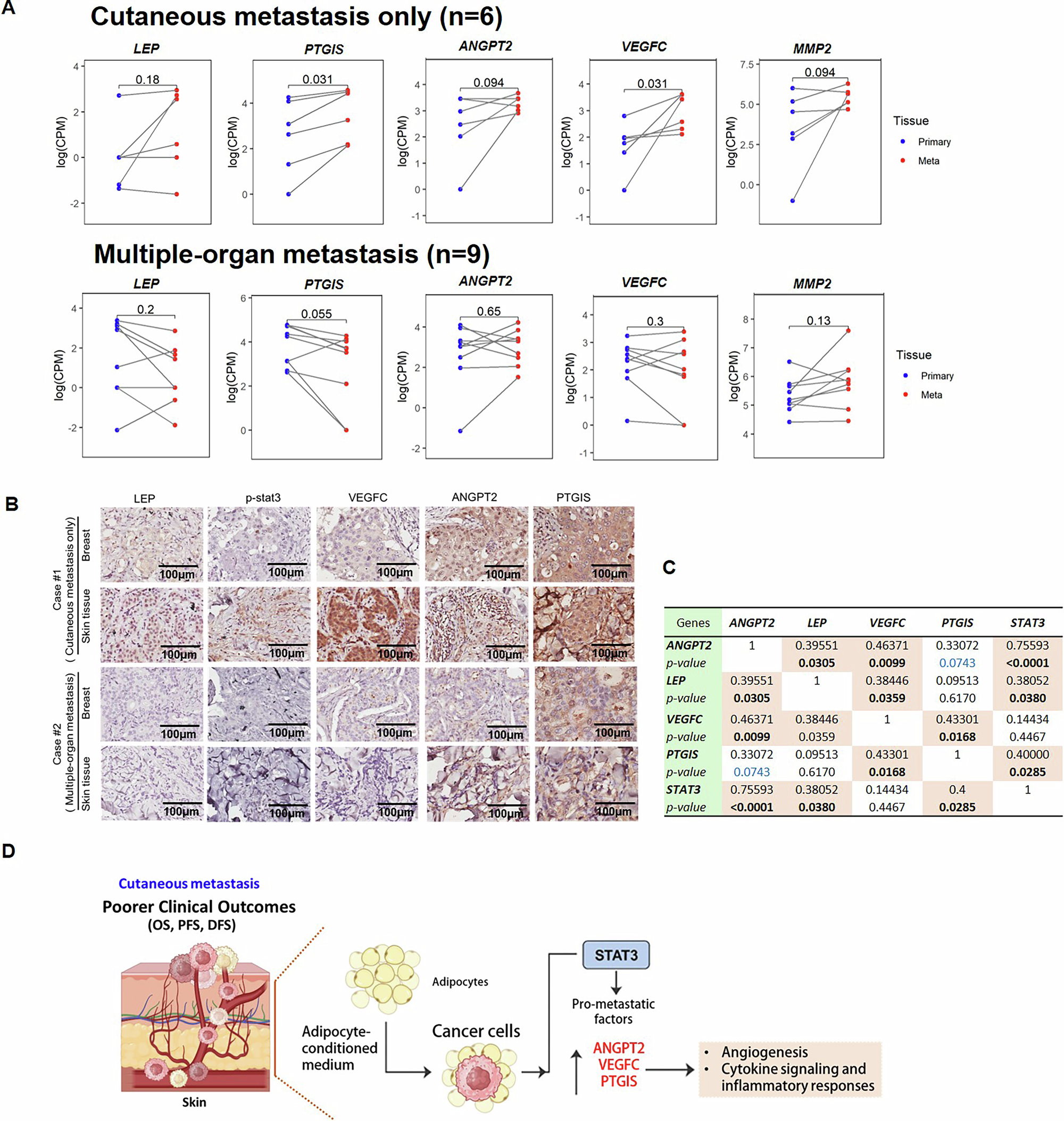 Fig. 7: Elevated expression of pro-metastatic genes in cutaneous metastases compared to primary breast tumors.