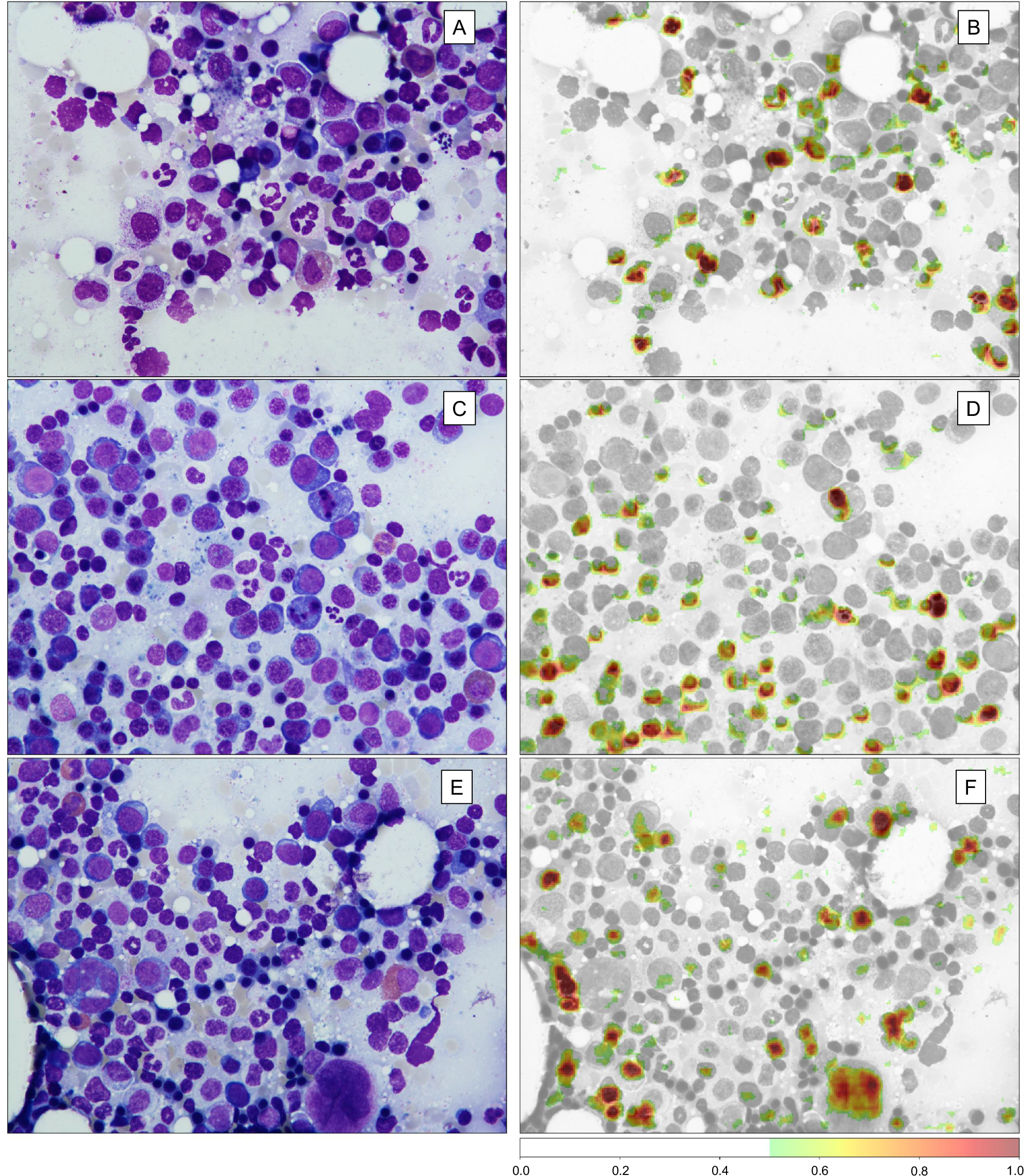 Fig. 2: Occlusion Sensitivity Mapping (OSM) highlights image areas with high importance for correct class predictions, enabling output interpretation.