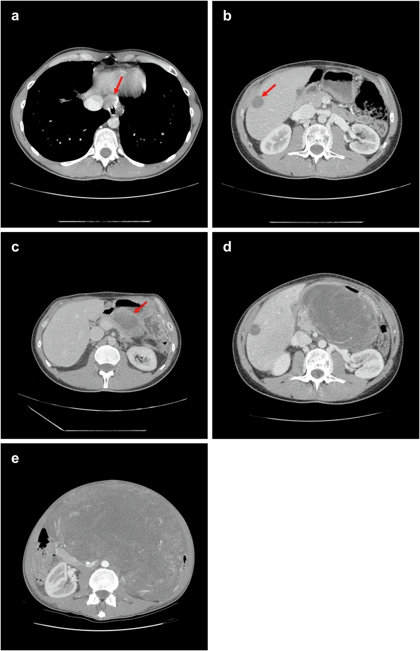 Fig. 2: CT imaging of the patient under treatment.