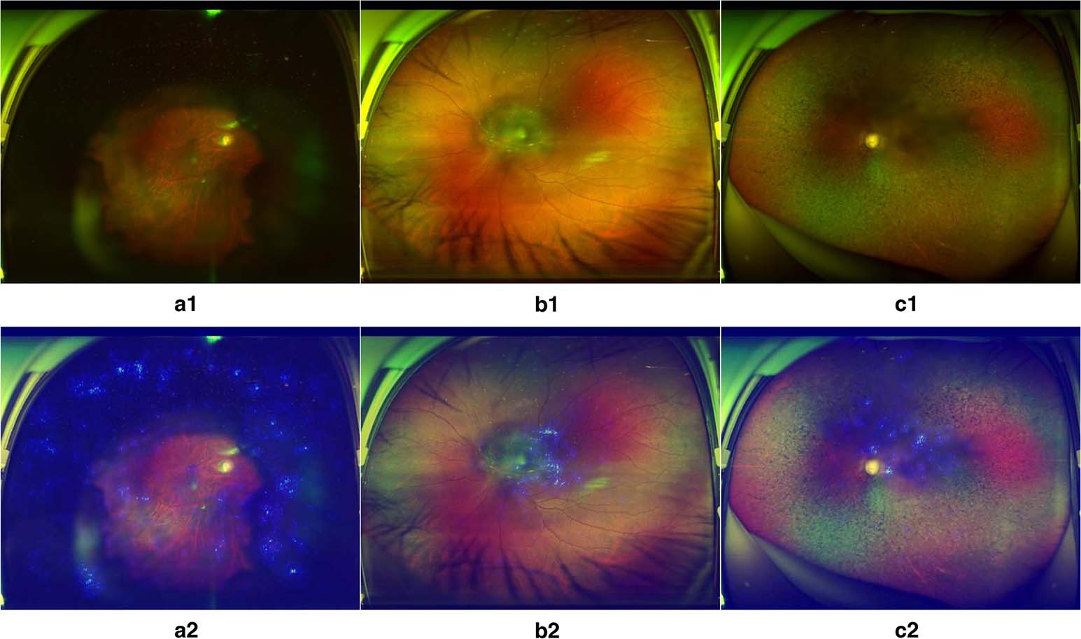 Fig. 3: Heatmaps of poor-quality images detected by the DLIFS.